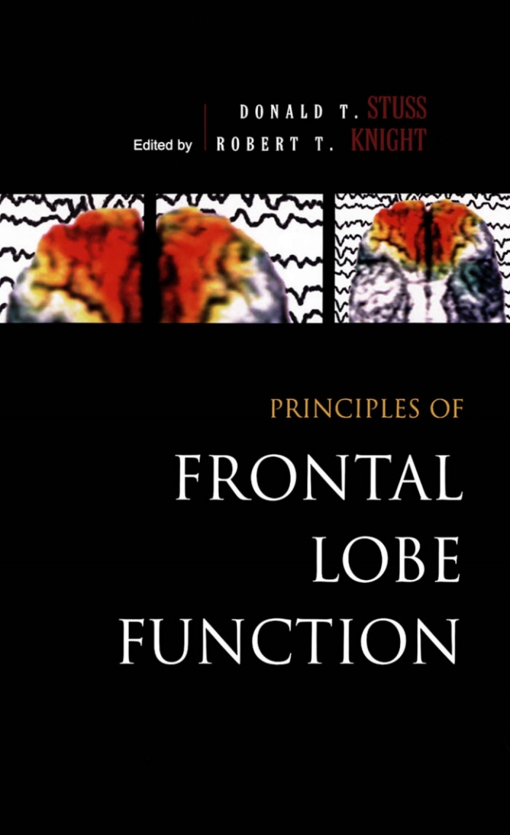 Principles of Frontal Lobe Function 1st Edition â€“ PDF/EPUB Version Downloadable