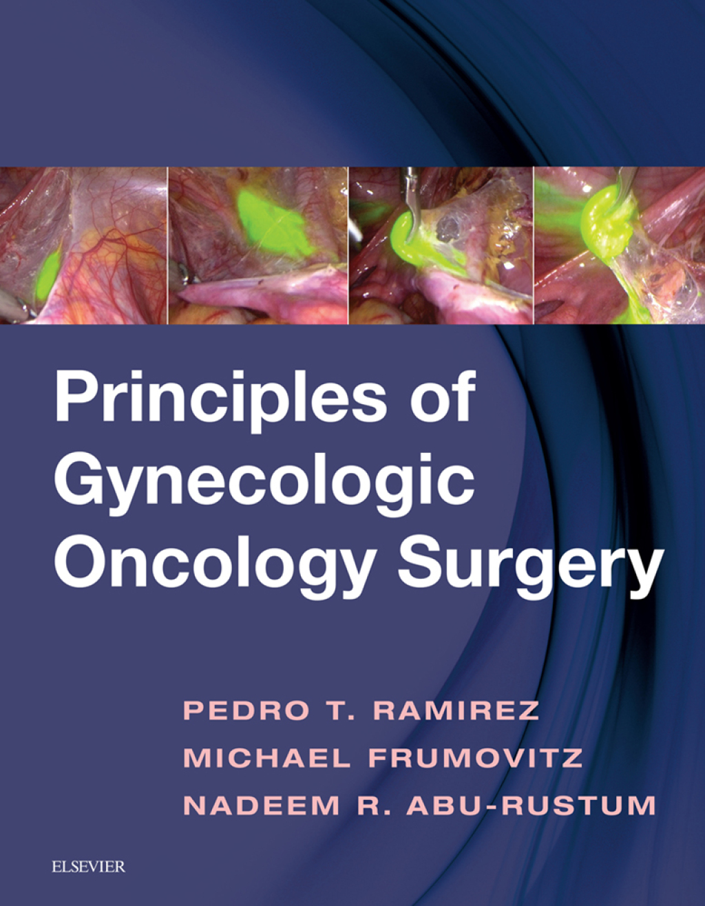 Principles of Gynecologic Oncology Surgery E-Book  â€“ PDF/EPUB Version Downloadable
