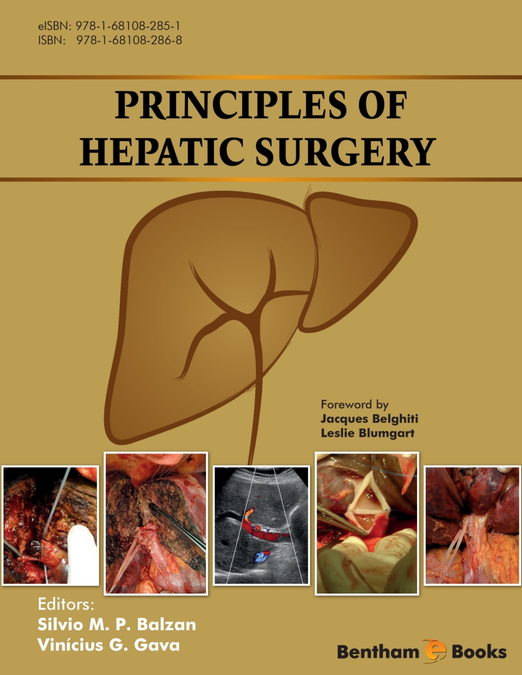 Principles of Hepatic Surgery 1st Edition â€“ PDF/EPUB Version Downloadable