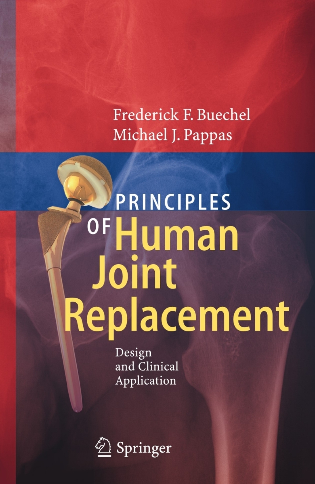 Principles of Human Joint Replacement Design and Clinical Application  â€“ PDF/EPUB Version Downloadable