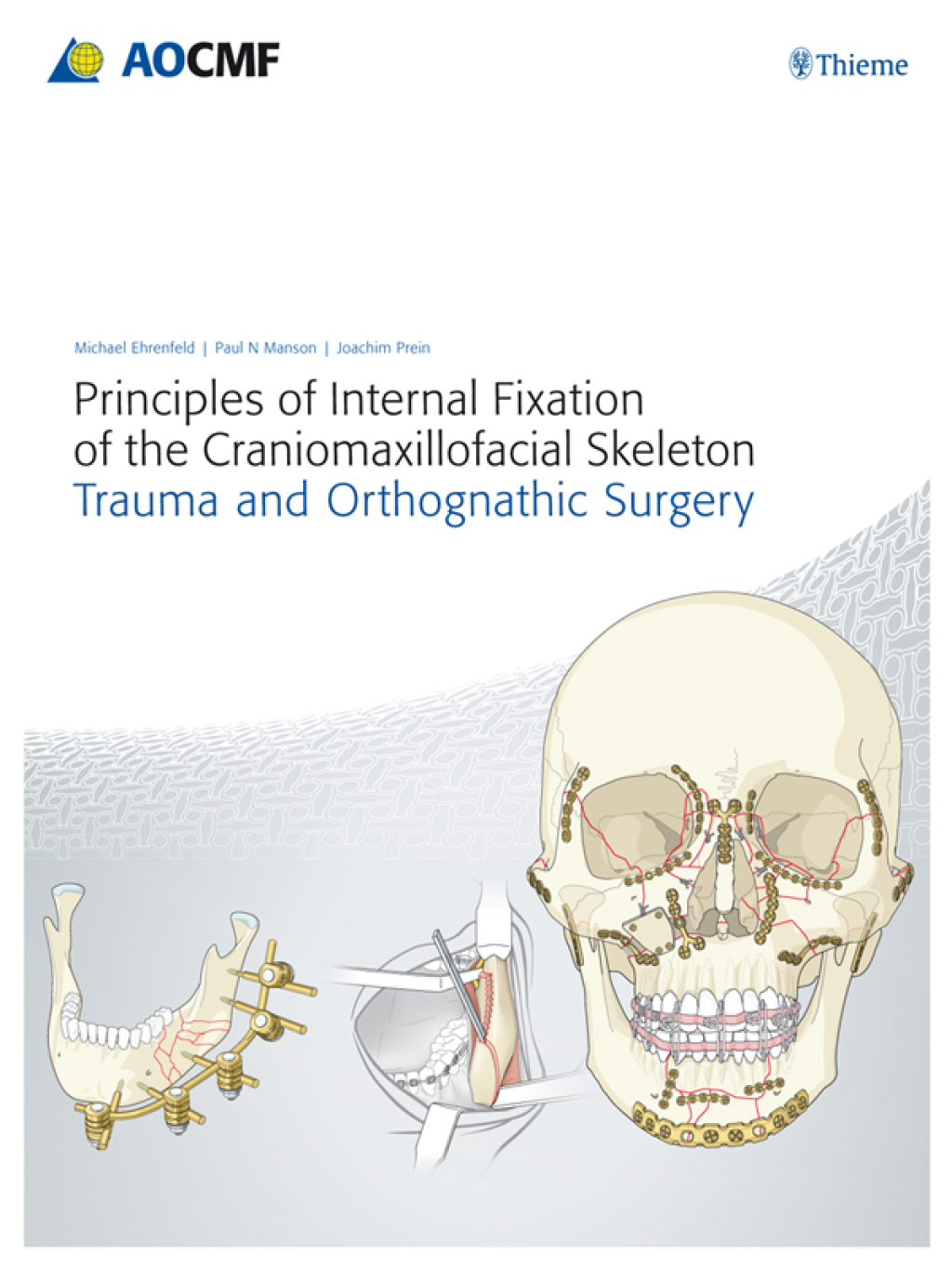 Principles of Internal Fixation of the Craniomaxillofacial Skeleton Trauma and Othognathic Surgery 1st Edition â€“ PDF/EPUB Version Downloadable
