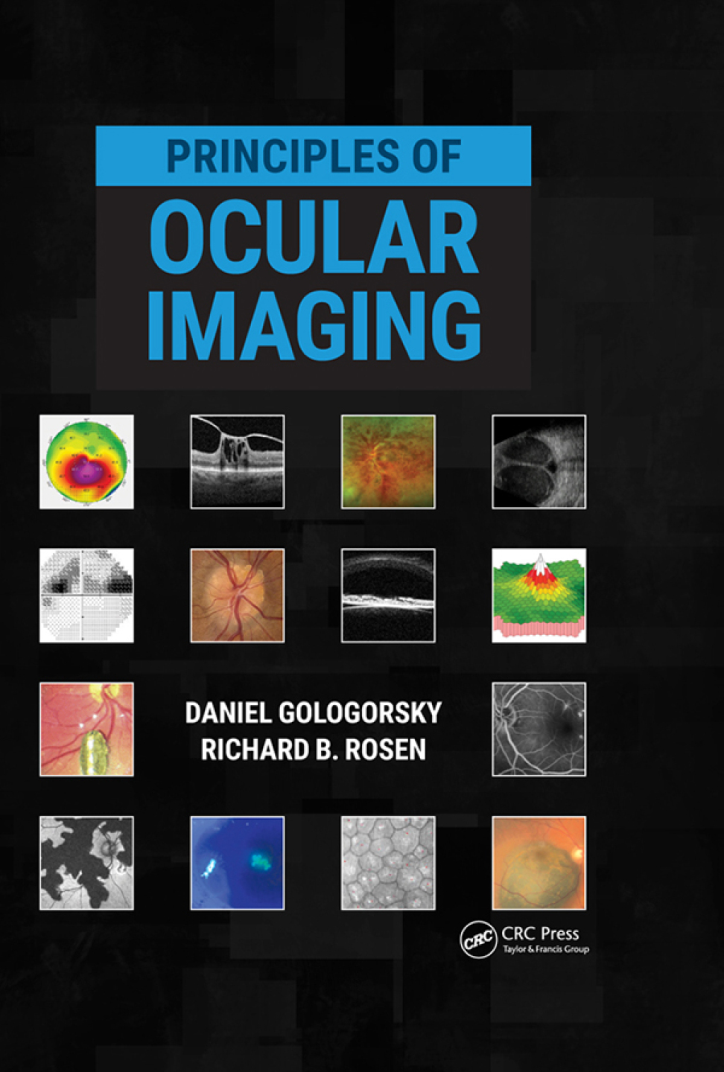 Principles of Ocular Imaging 1st Edition â€“ PDF/EPUB Version Downloadable