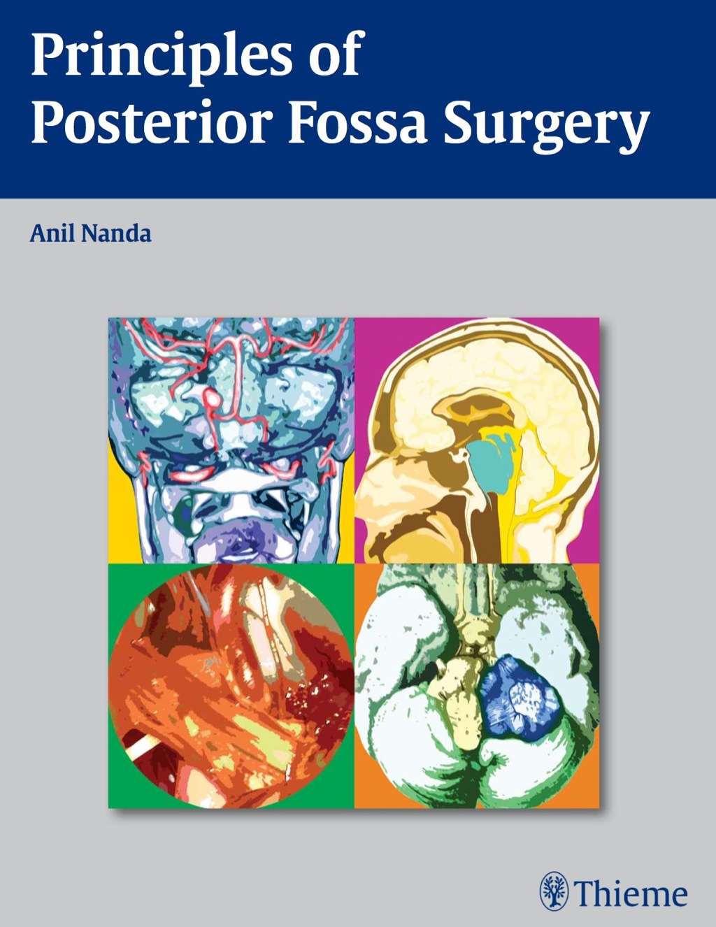 Principles of Posterior Fossa Surgery 1st Edition â€“ PDF/EPUB Version Downloadable