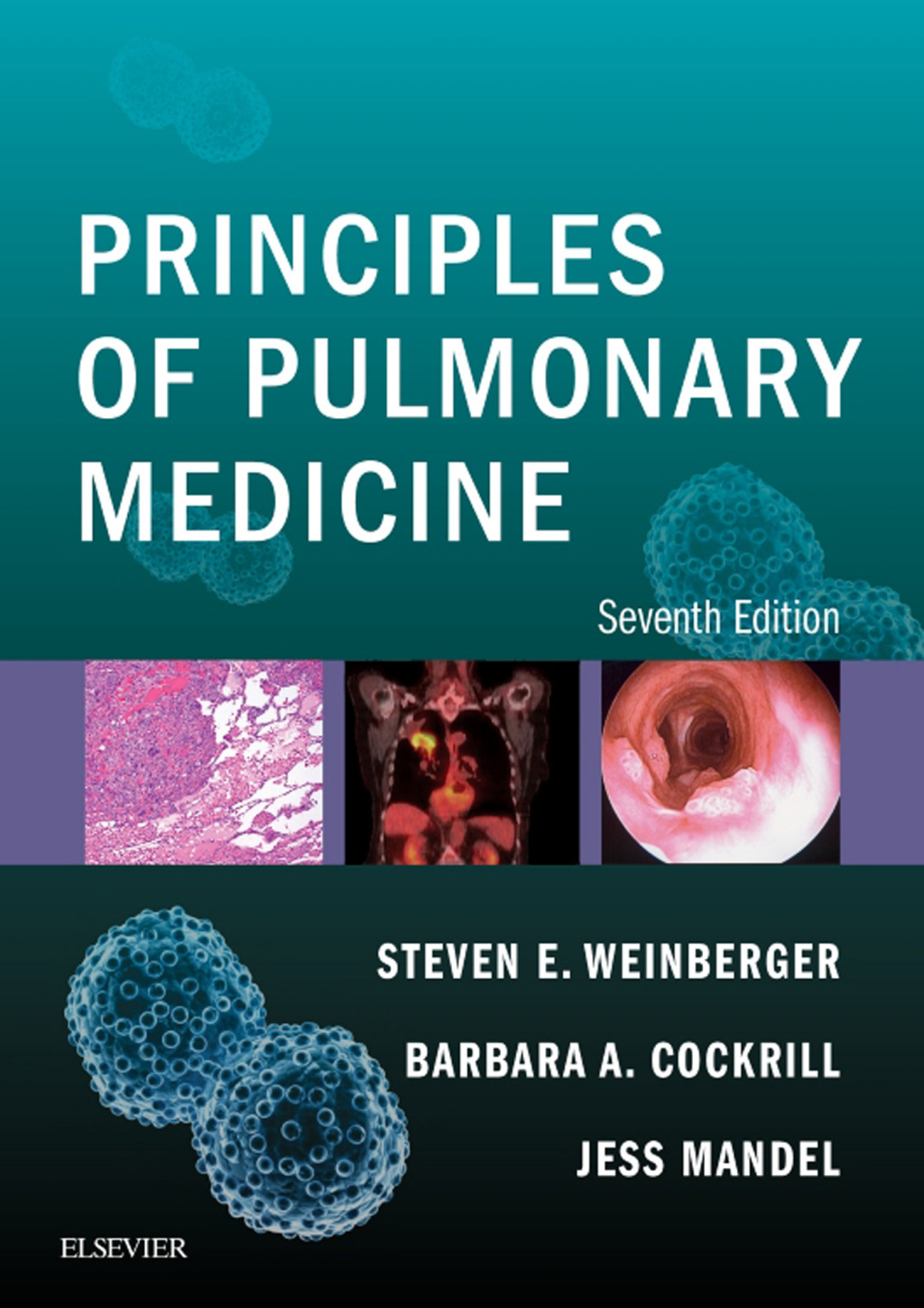 Principles of Pulmonary Medicine 7th Edition â€“ PDF/EPUB Version Downloadable