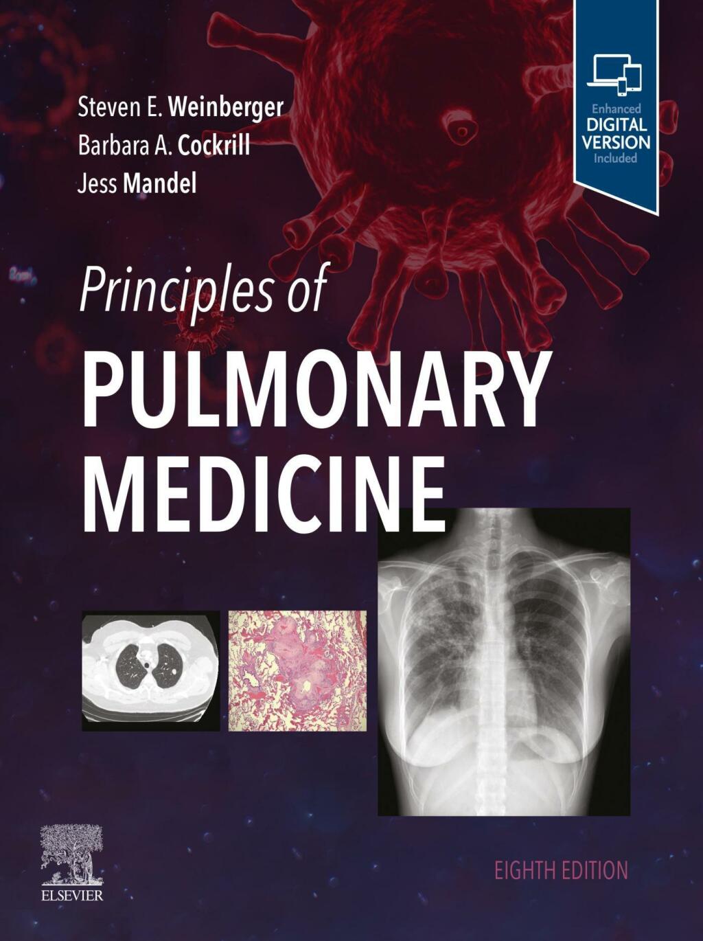 Principles of Pulmonary Medicine 8th Edition â€“ PDF/EPUB Version Downloadable