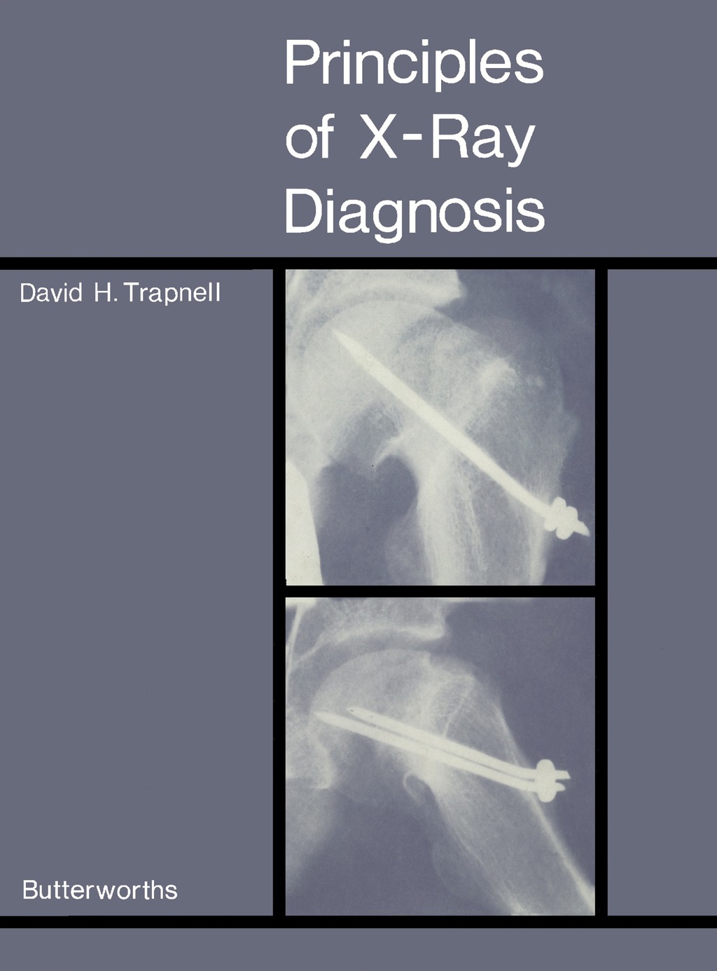 Principles of X-Ray Diagnosis  â€“ PDF/EPUB Version Downloadable
