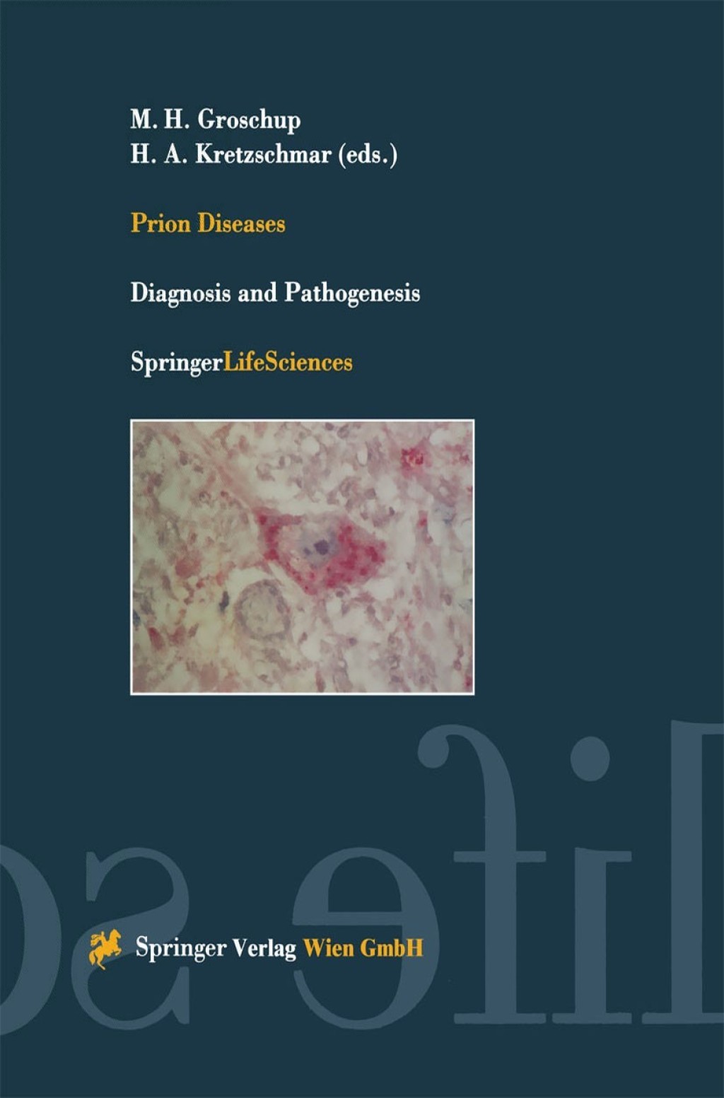 Prion Diseases Diagnosis and Pathogenesis 1st Edition â€“ PDF/EPUB Version Downloadable