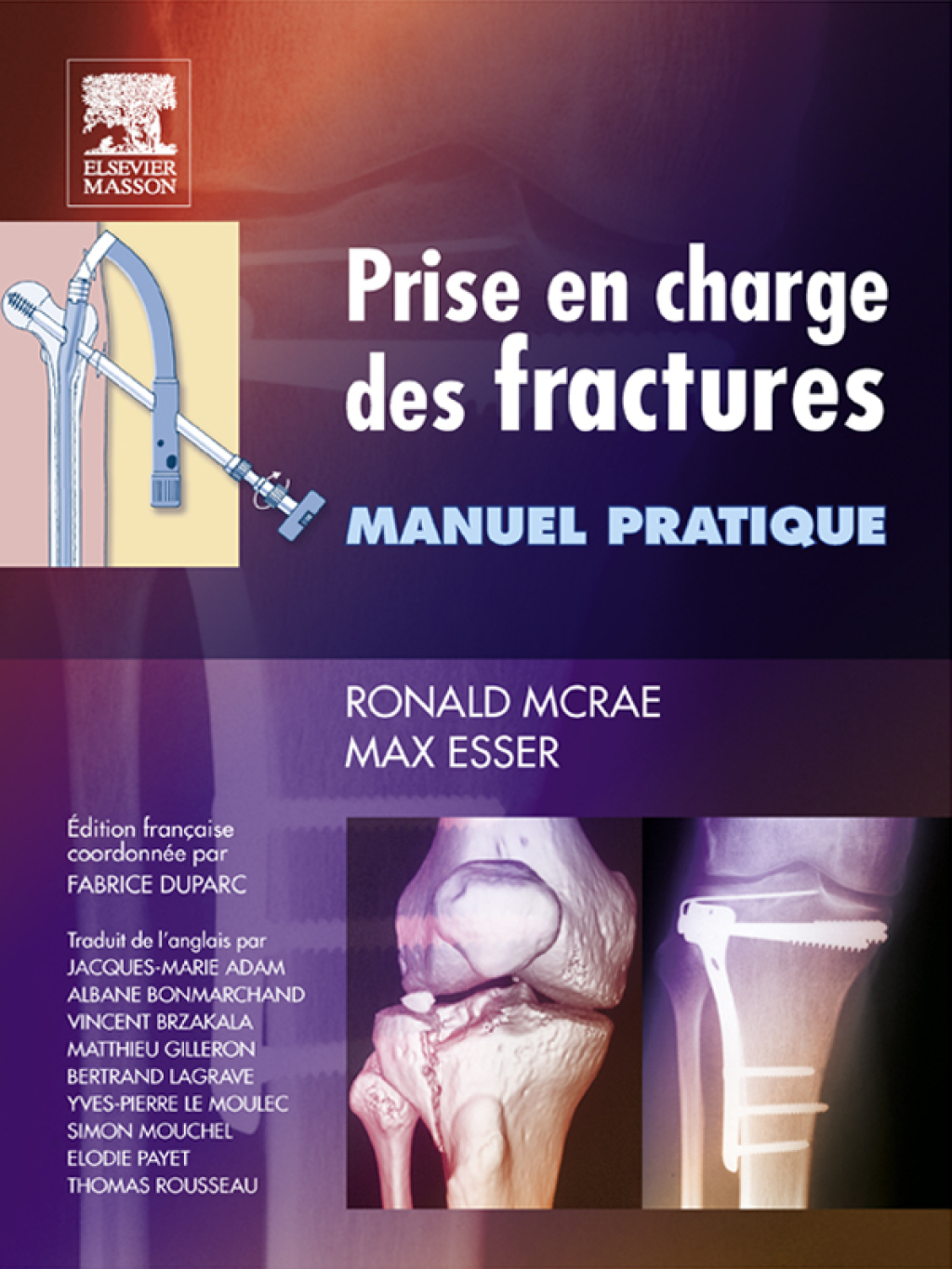 Prise en charge des fractures Manuel pratique  â€“ PDF/EPUB Version Downloadable