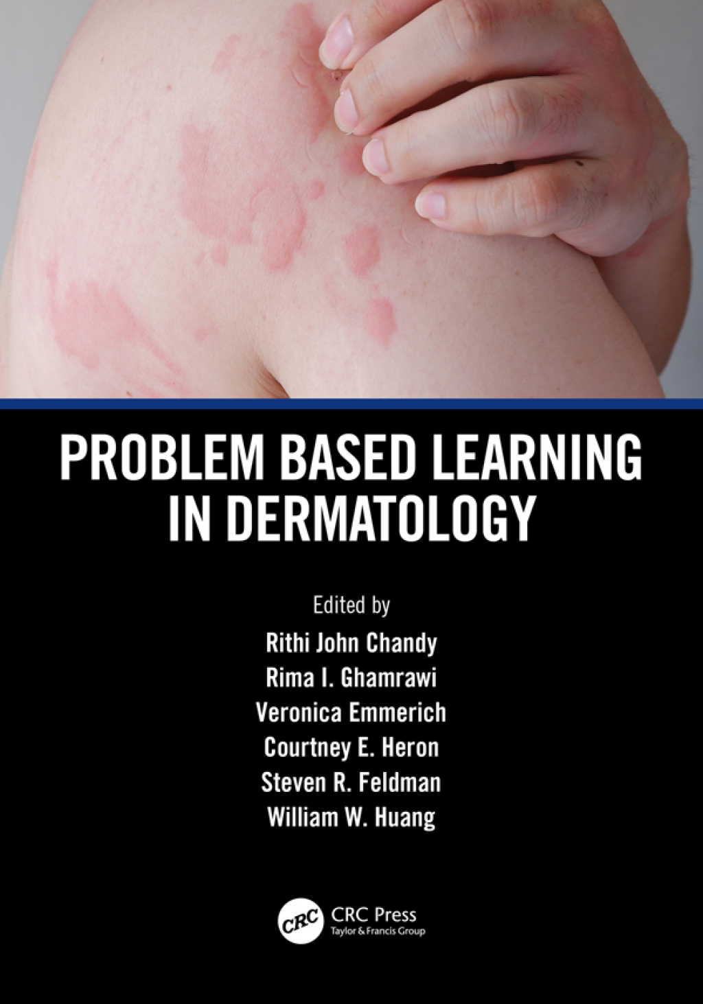 Problem Based Learning in Dermatology 1st Edition â€“ PDF/EPUB Version Downloadable