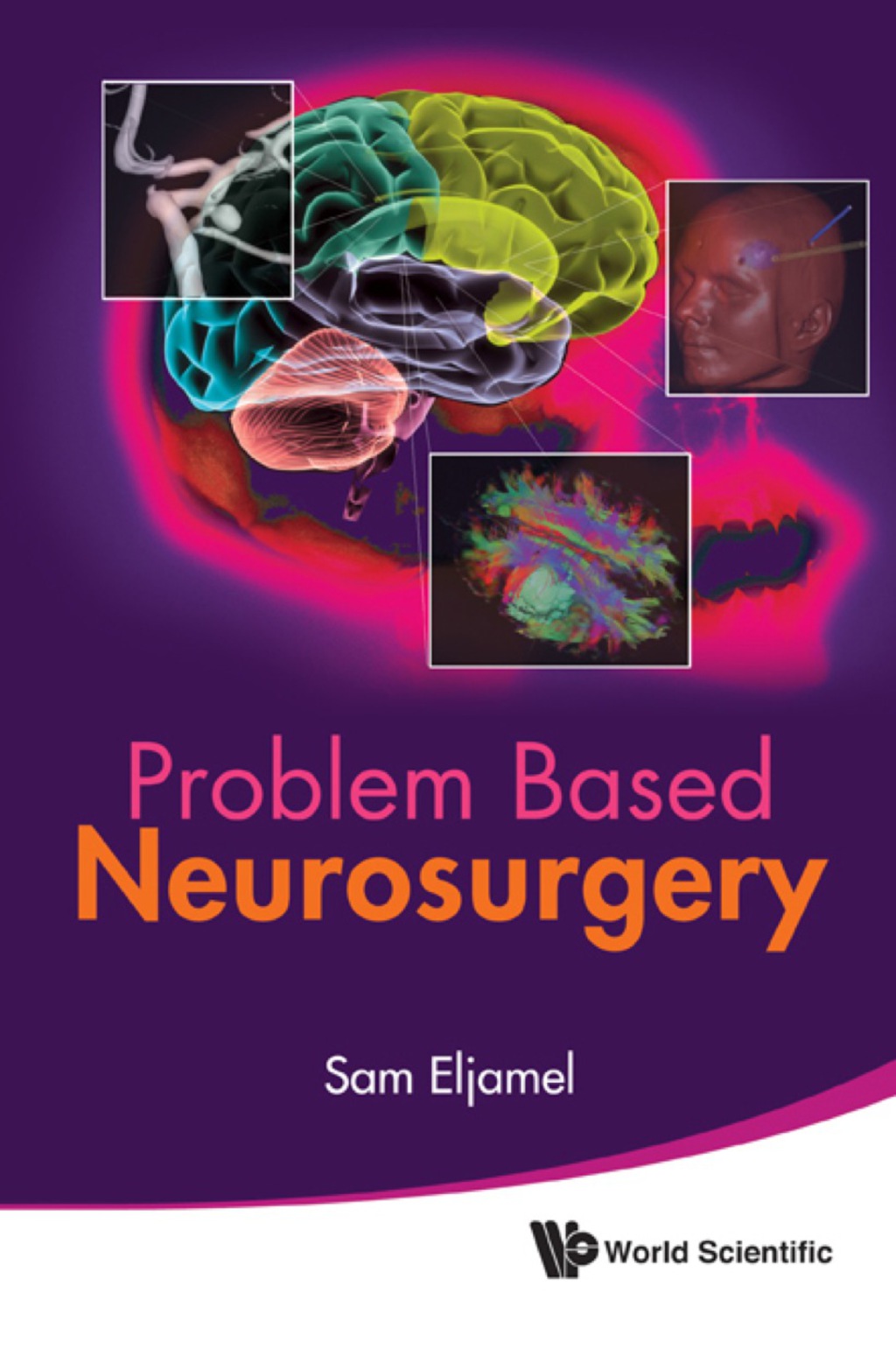 PROBLEM BASED NEUROSURGERY  â€“ PDF/EPUB Version Downloadable