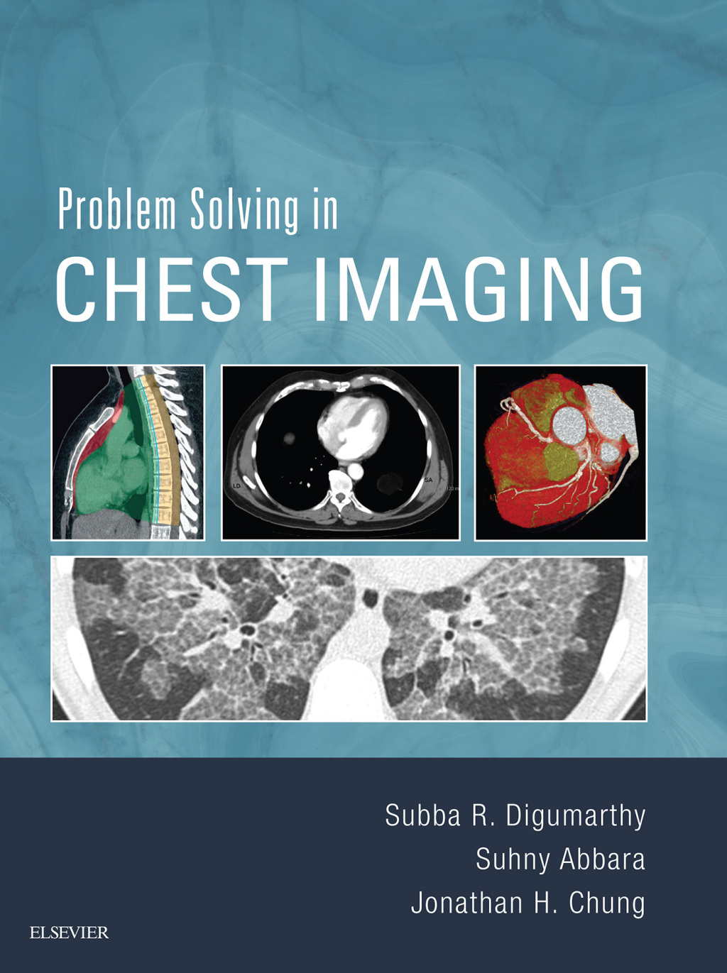 Problem Solving in Chest Imaging  â€“ PDF/EPUB Version Downloadable