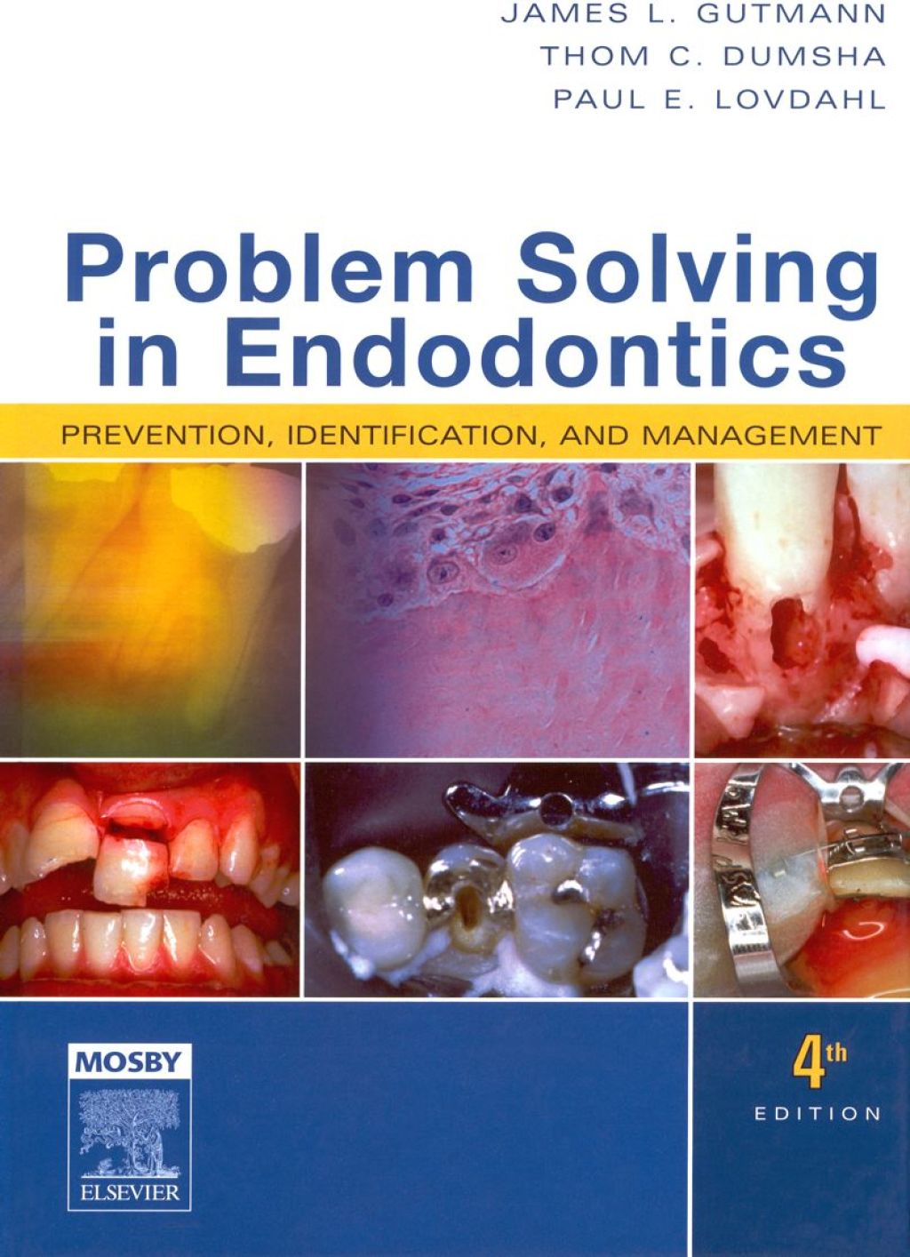 Problem Solving in Endodontics: Prevention, Identification, and Management 4th Edition â€“ PDF/EPUB Version Downloadable