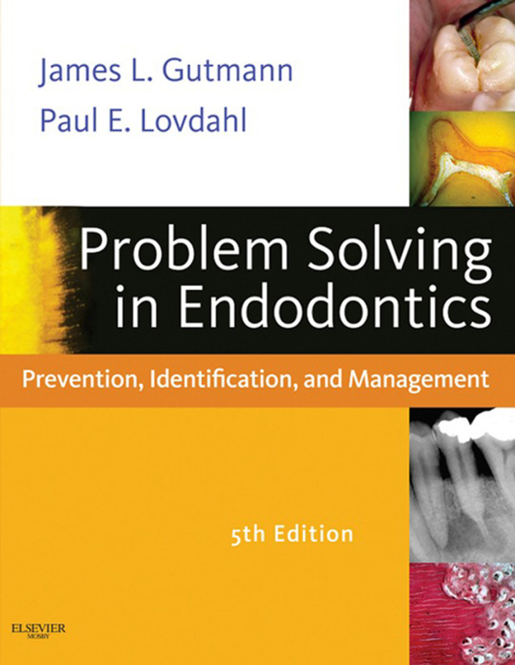 Problem Solving in Endodontics Prevention, Identification and Management 5th Edition â€“ PDF/EPUB Version Downloadable