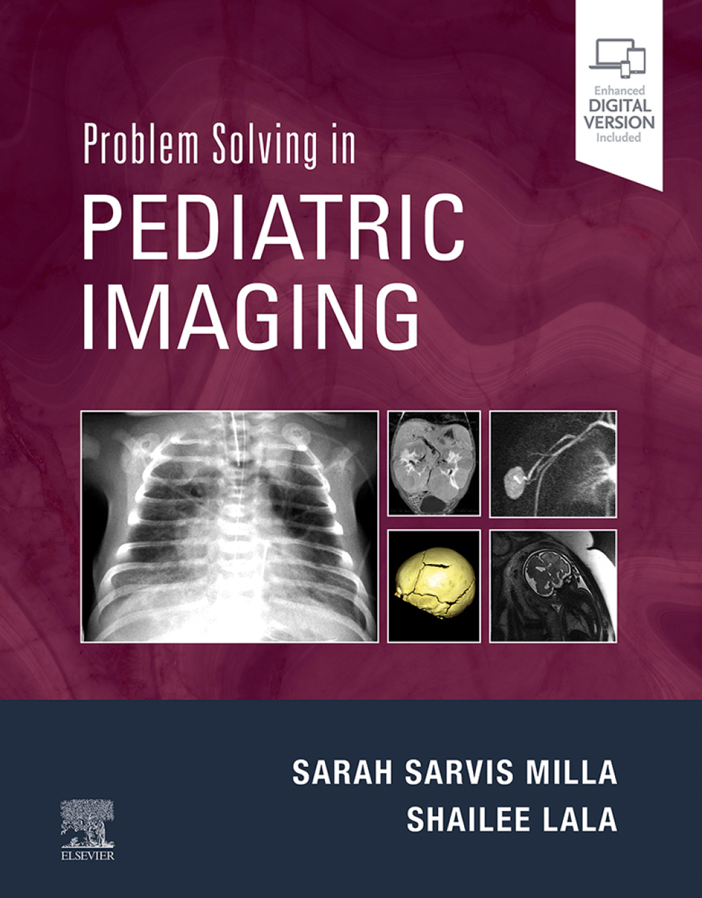 Problem Solving in Pediatric Imaging E-Book  â€“ PDF/EPUB Version Downloadable