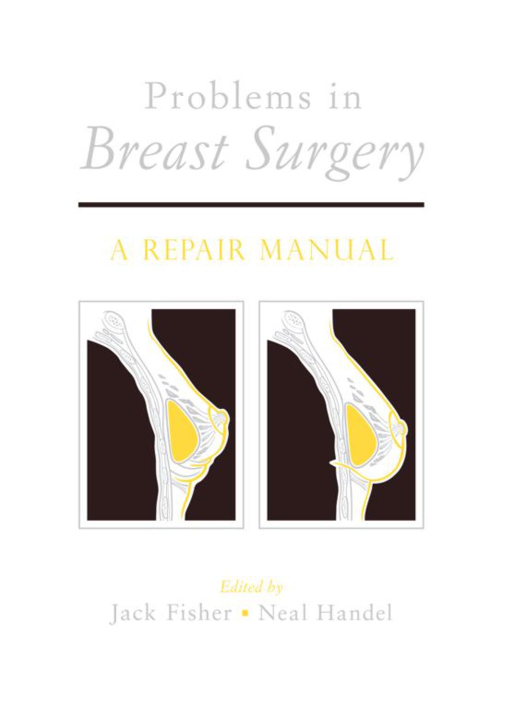 Problems in Breast Surgery 1st Edition â€“ PDF/EPUB Version Downloadable
