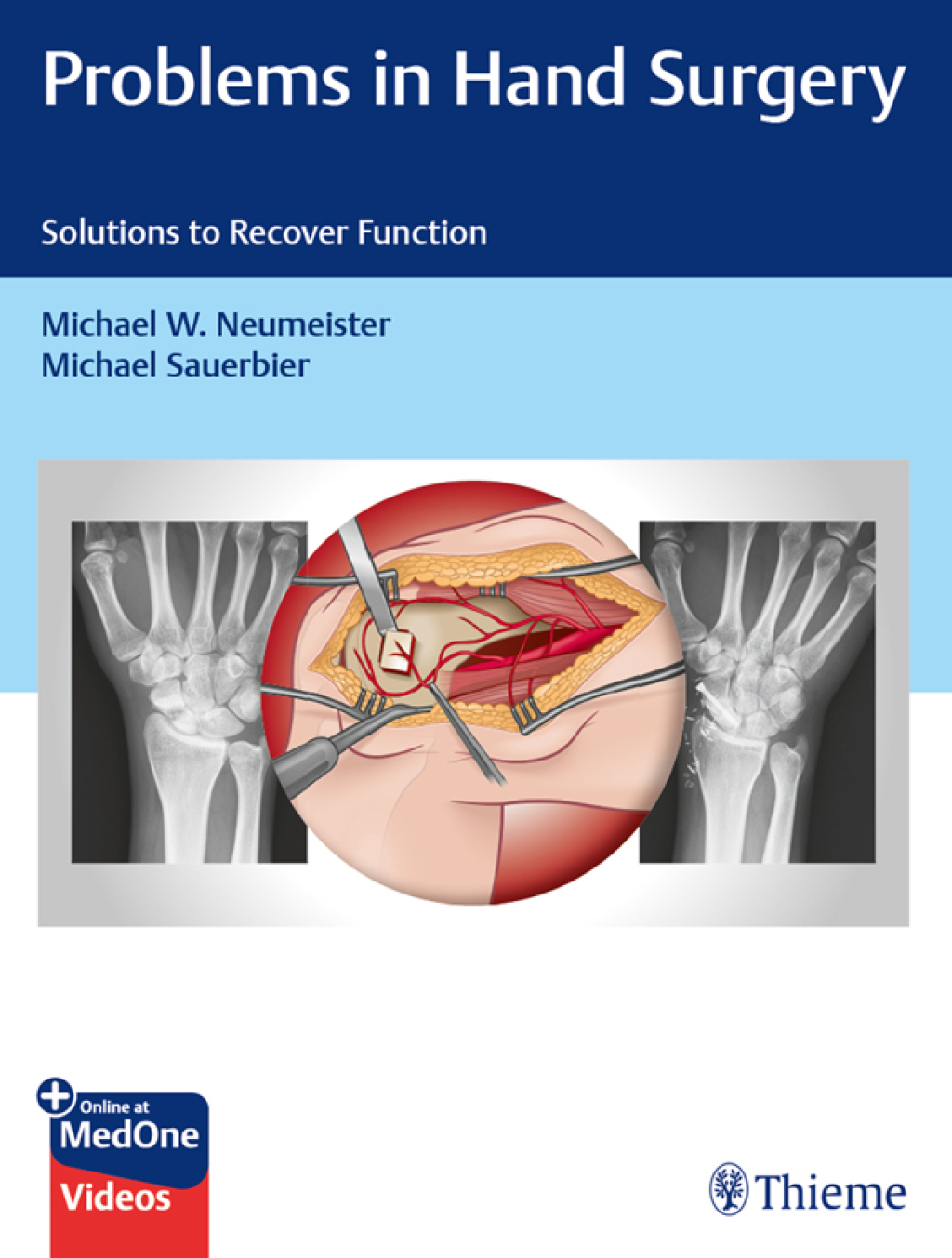 Problems in Hand Surgery Solutions to Recover Function 1st Edition â€“ PDF/EPUB Version Downloadable