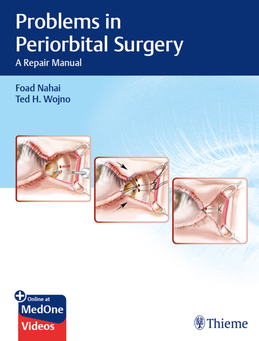Problems in Periorbital Surgery A Repair Manual 1st Edition â€“ PDF/EPUB Version Downloadable