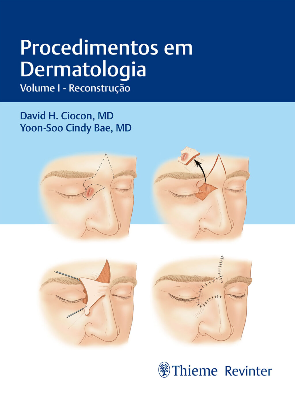 Procedimentos em Dermatologia: ReconstruÃ§Ã£o. v.I 1st Edition â€“ PDF/EPUB Version Downloadable