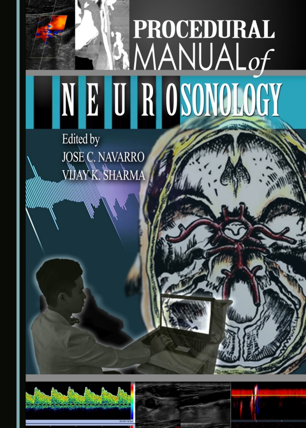 Procedural Manual of Neurosonology 1st Edition â€“ PDF/EPUB Version Downloadable