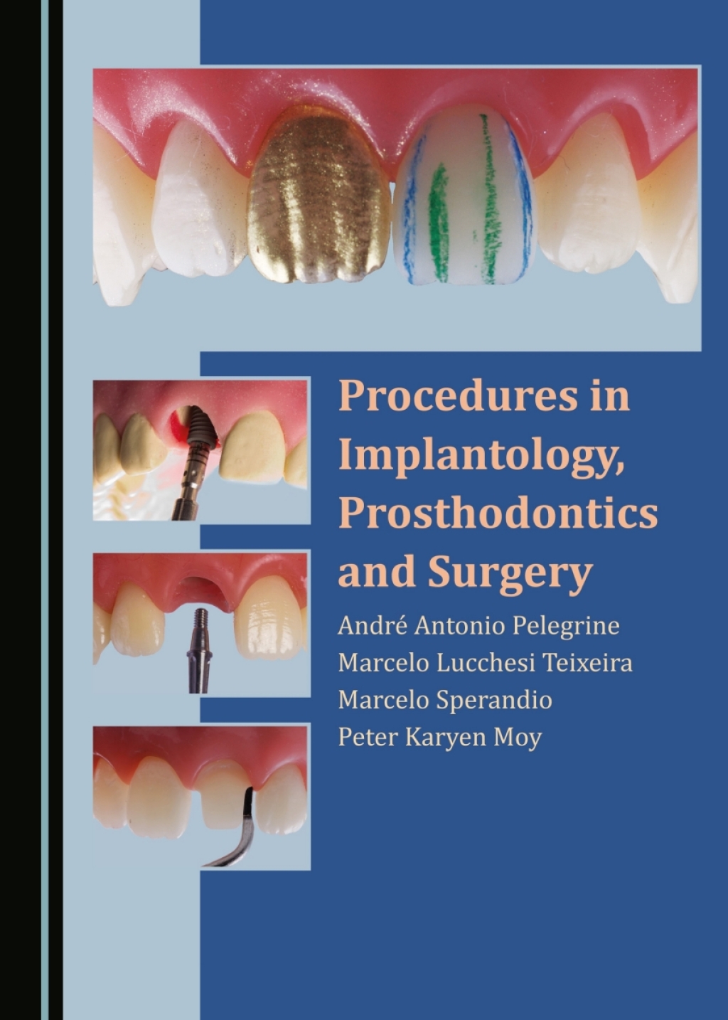 Procedures in Implantology, Prosthodontics and Surgery 1st Edition â€“ PDF/EPUB Version Downloadable