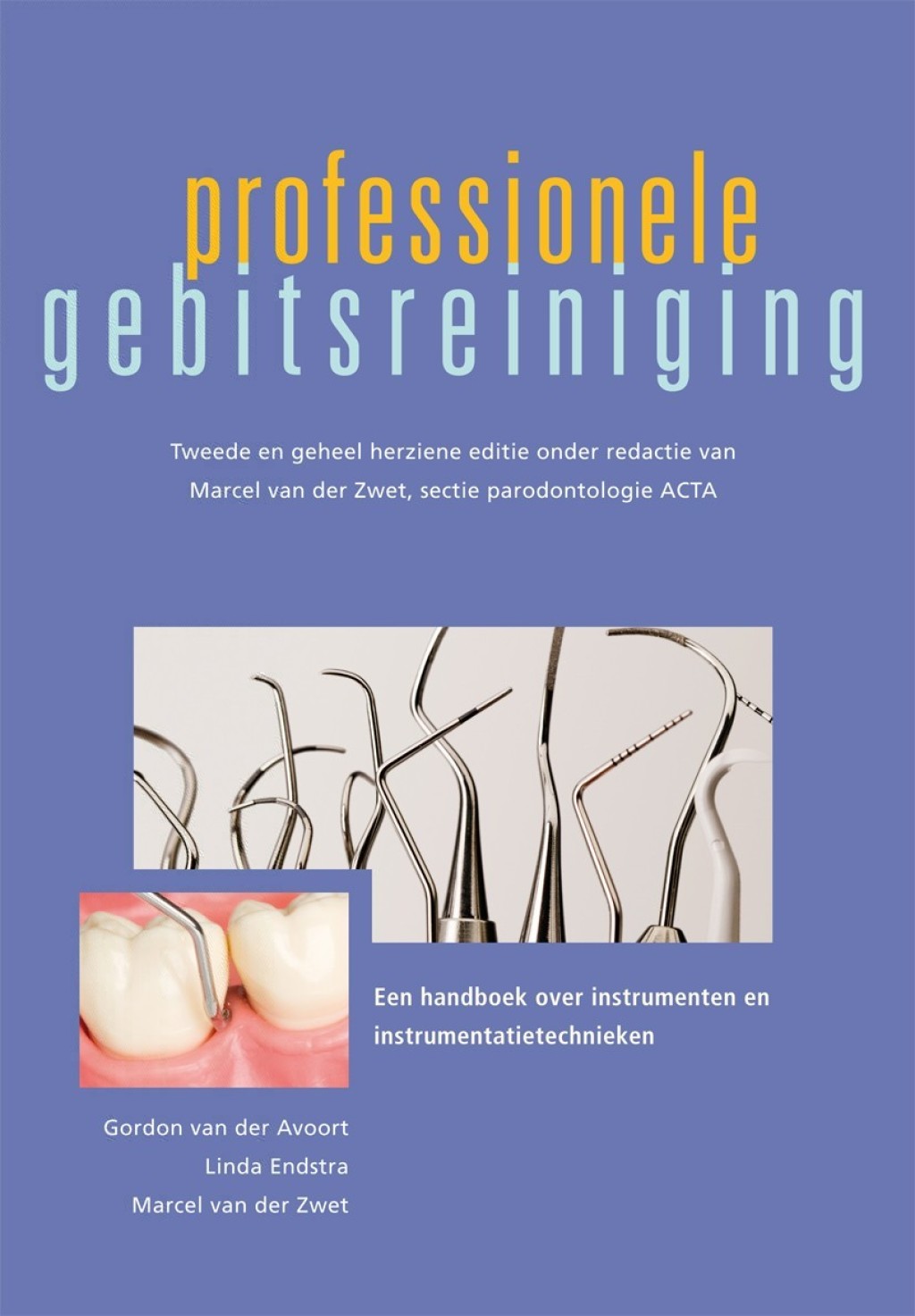 Professionele gebitsreiniging Een handboek over instrumenten en instrumentatietechnieken 2nd Edition â€“ PDF/EPUB Version Downloadable