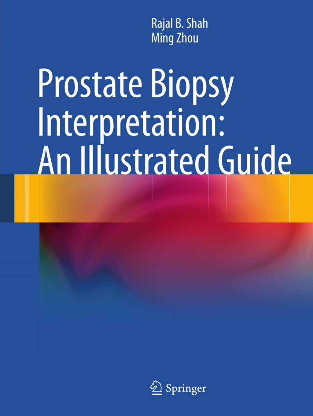 Prostate Biopsy Interpretation: An Illustrated Guide  â€“ PDF/EPUB Version Downloadable