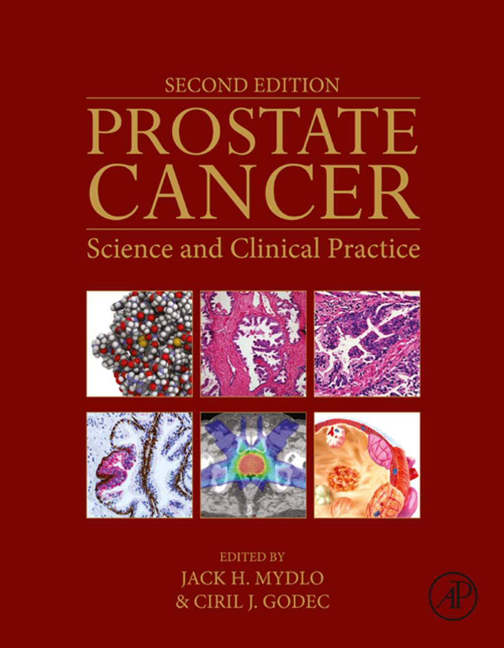 Prostate Cancer 2nd Edition â€“ PDF/EPUB Version Downloadable