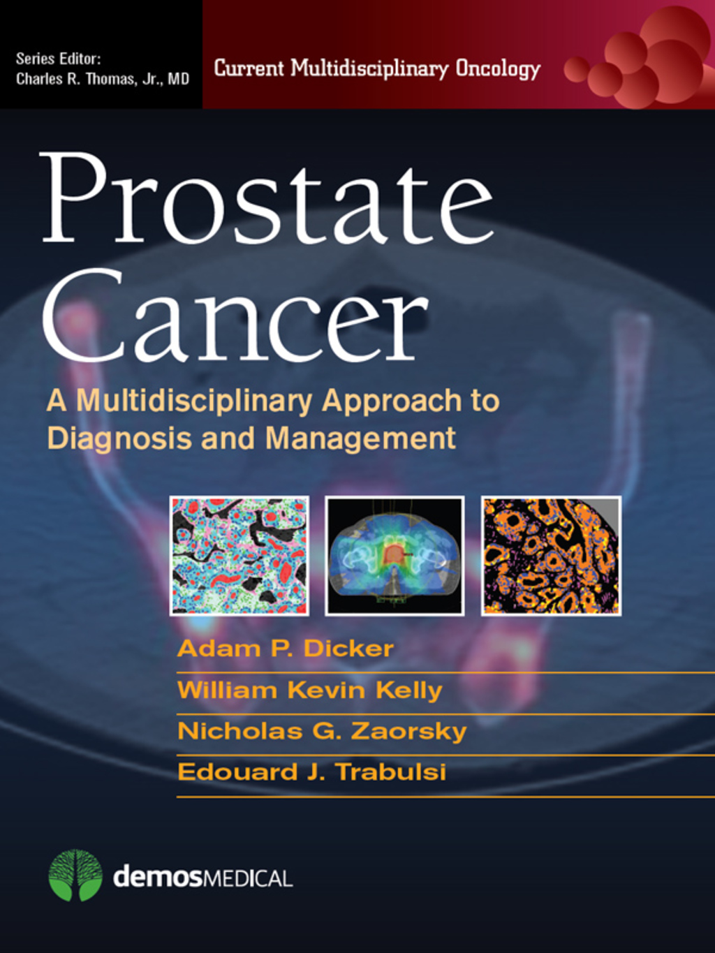 Prostate Cancer A Multidisciplinary Approach to Diagnosis and Management 1st Edition â€“ PDF/EPUB Version Downloadable