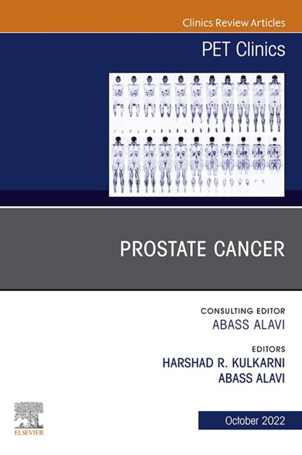 Prostate Cancer, An Issue of PET Clinics 1st Edition â€“ PDF/EPUB Version Downloadable