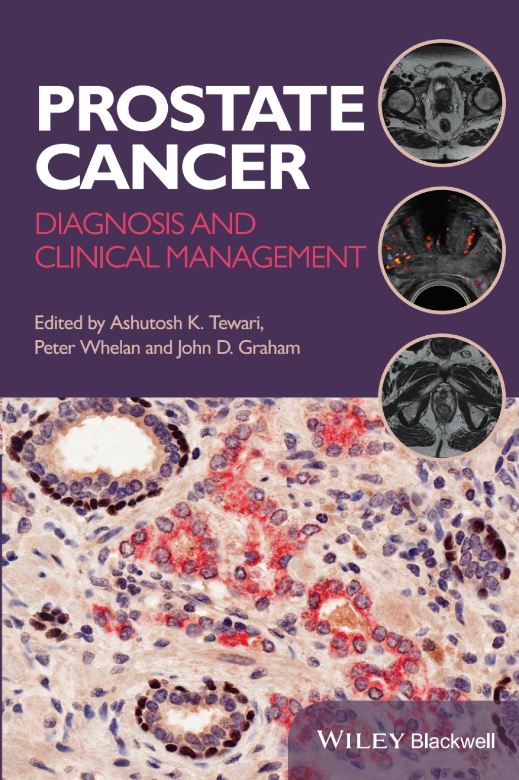 Prostate Cancer Diagnosis and Clinical Management 1st Edition – PDF/EPUB Version Downloadable Prostate Cancer Diagnosis and Clinical Management 1st Edition – PDF/EPUB Version Downloadable - Image 1