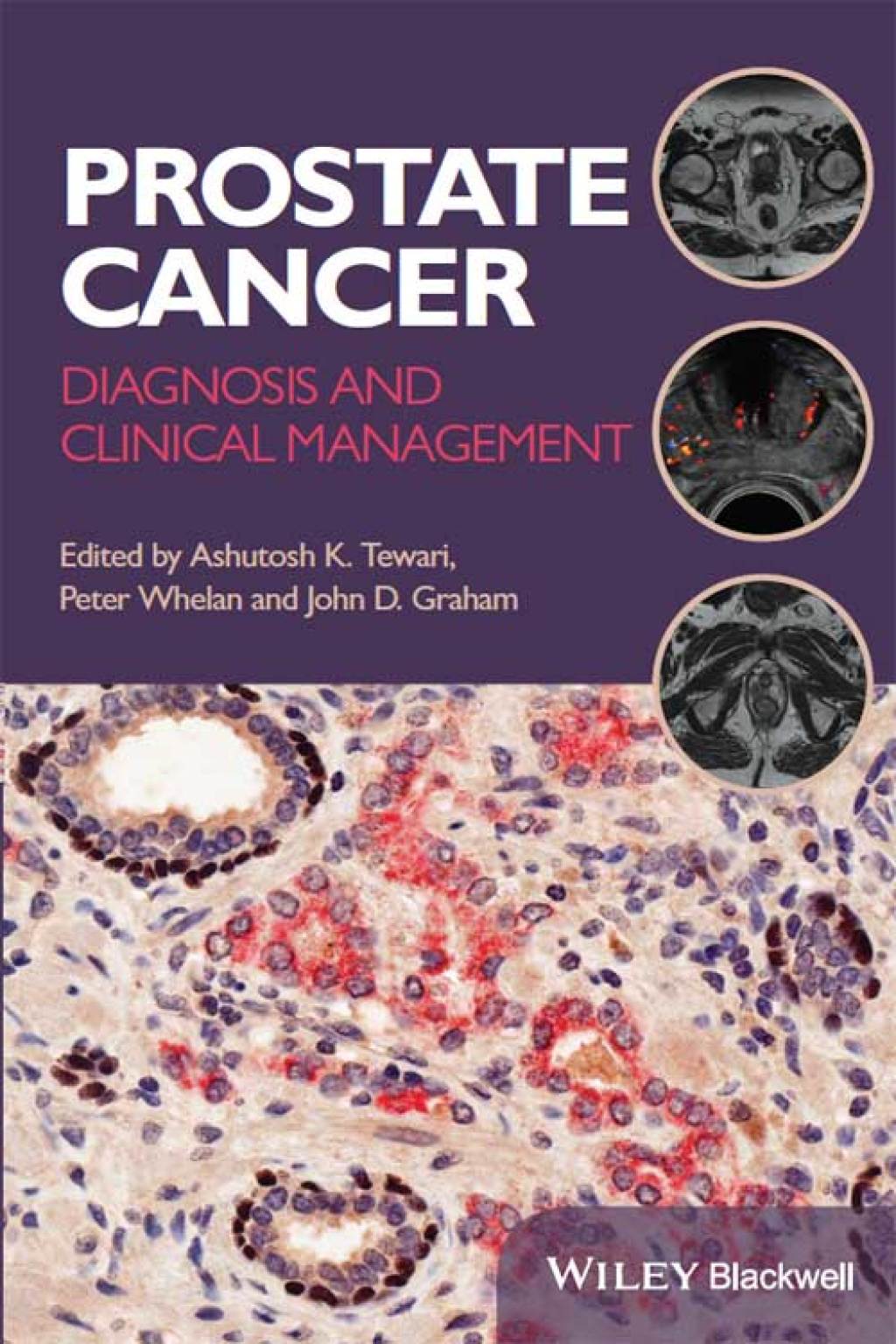 Prostate Cancer Diagnosis and Clinical Management 1st Edition â€“ PDF/EPUB Version Downloadable