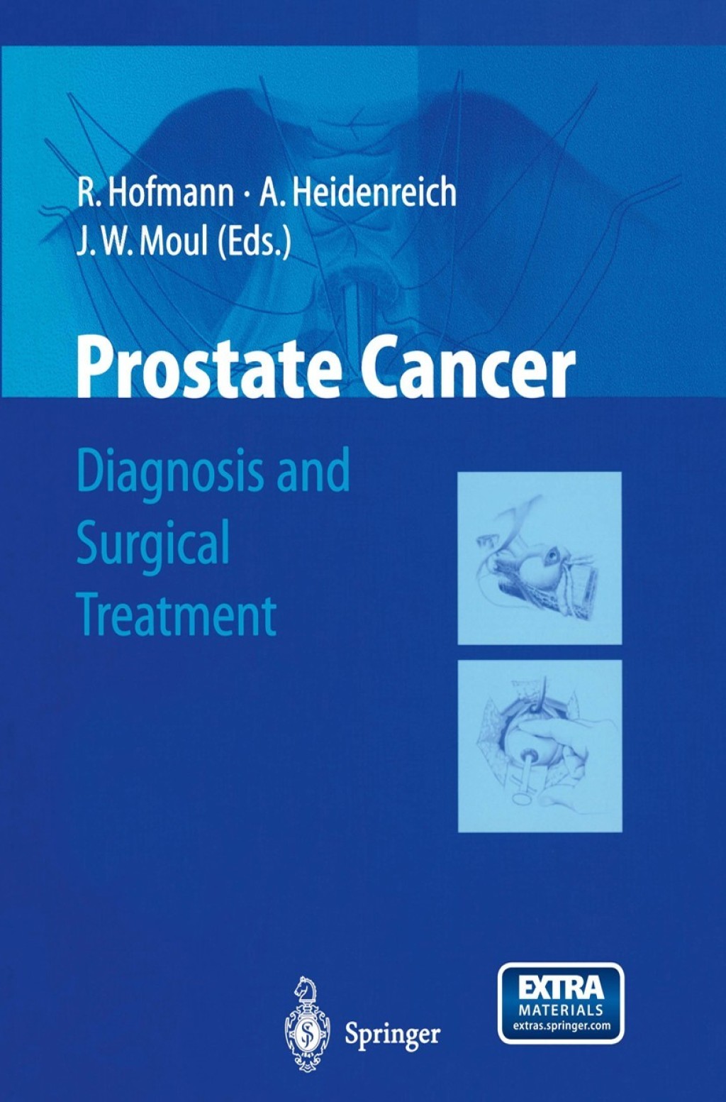 Prostate Cancer Diagnosis and Surgical Treatment 1st Edition â€“ PDF/EPUB Version Downloadable