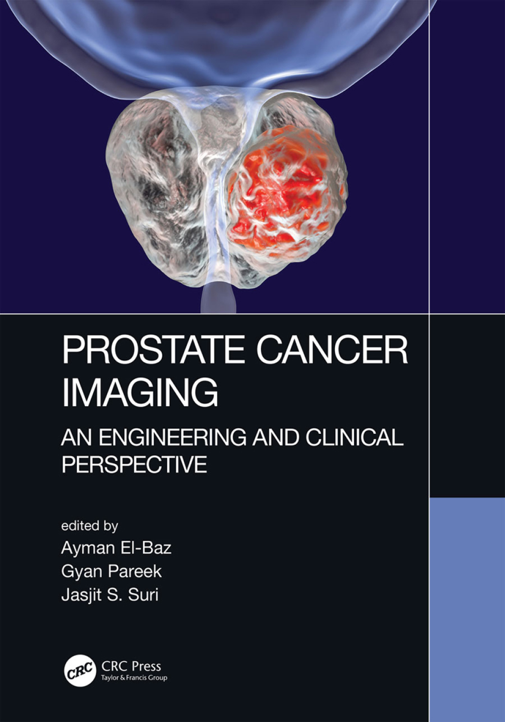 Prostate Cancer Imaging An Engineering and Clinical Perspective 1st Edition â€“ PDF/EPUB Version Downloadable
