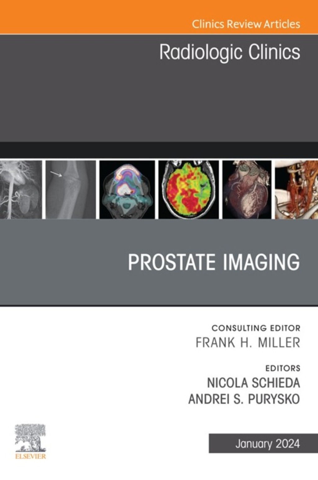 Prostate Imaging, An Issue of Radiologic Clinics of North America 1st Edition â€“ PDF/EPUB Version Downloadable
