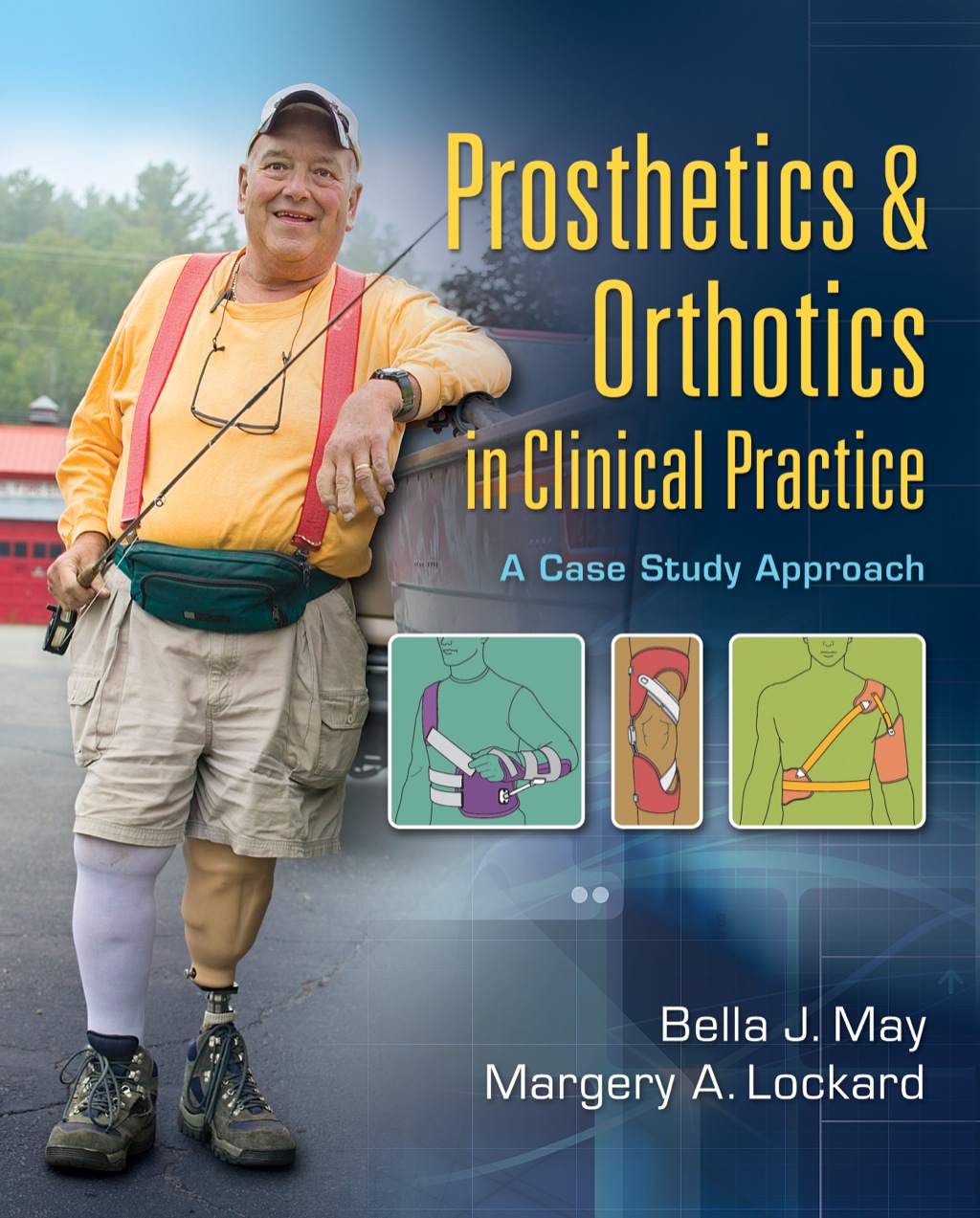 Prosthetics and Orthotics in Clinical Practice: A Case Study Approach 1st Edition â€“ PDF/EPUB Version Downloadable