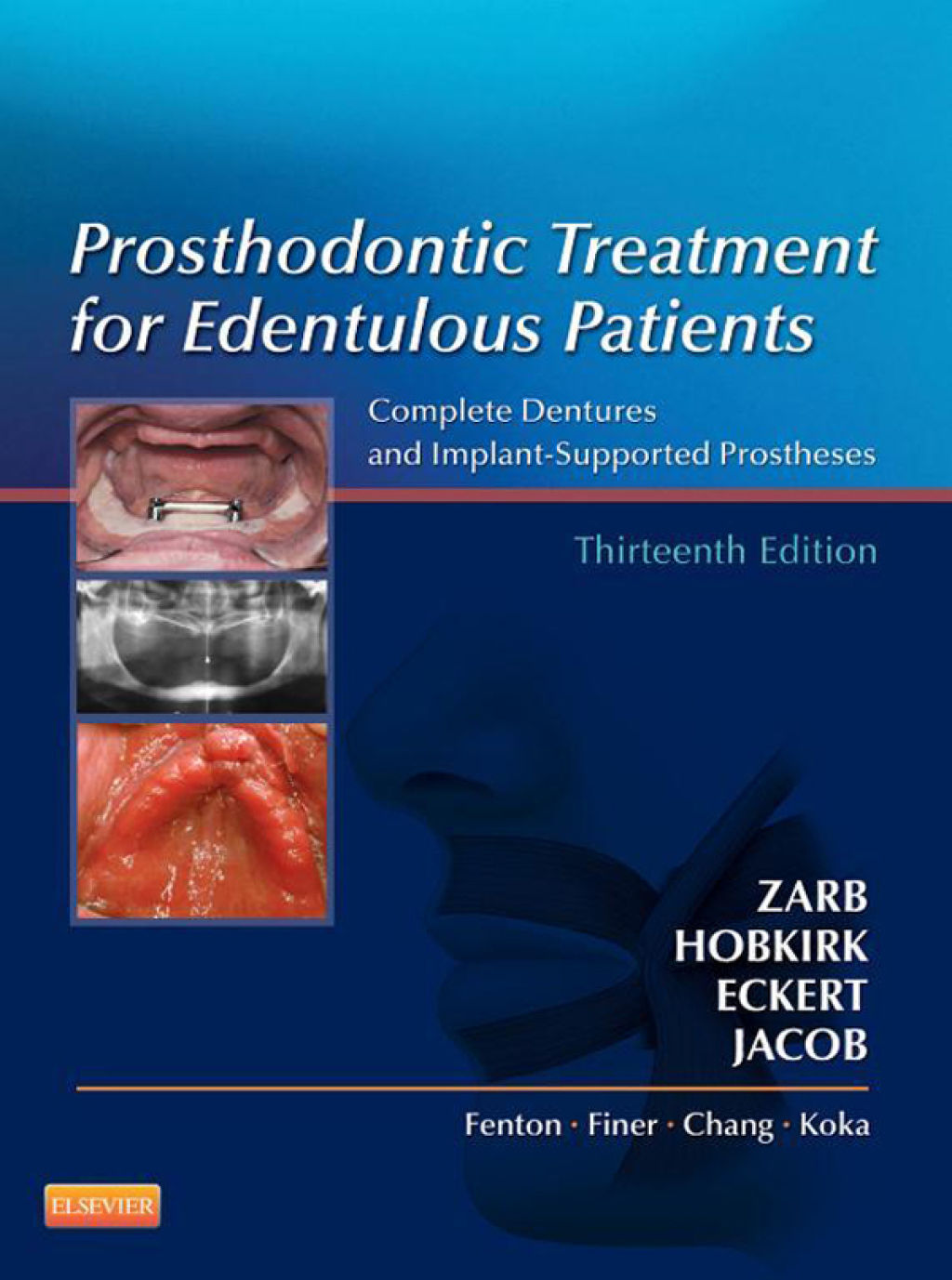 Prosthodontic Treatment for Edentulous Patients Complete Dentures and Implant-Supported Prostheses 13th Edition â€“ PDF/EPUB Version Downloadable