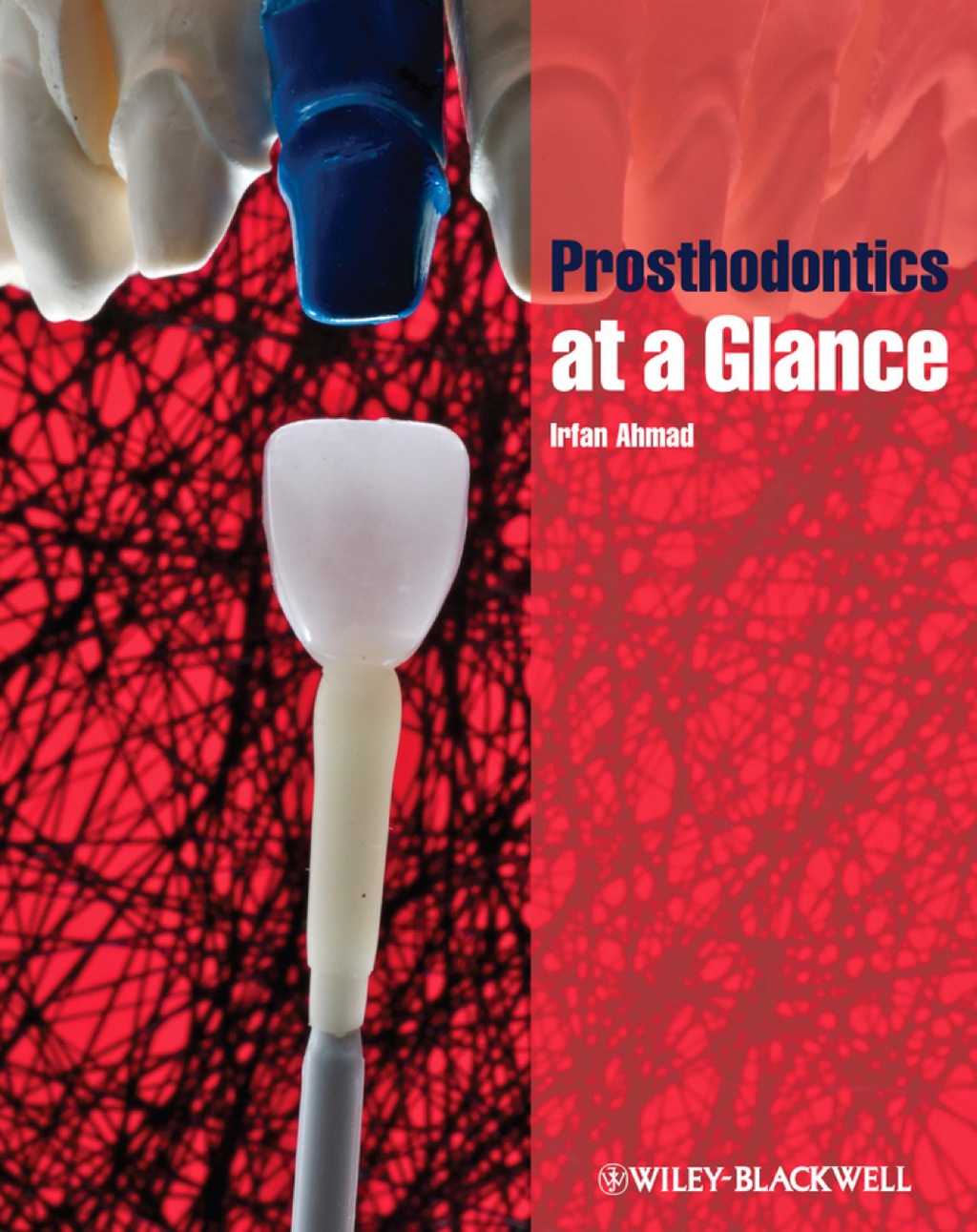 Prosthodontics at a Glance 1st Edition â€“ PDF/EPUB Version Downloadable