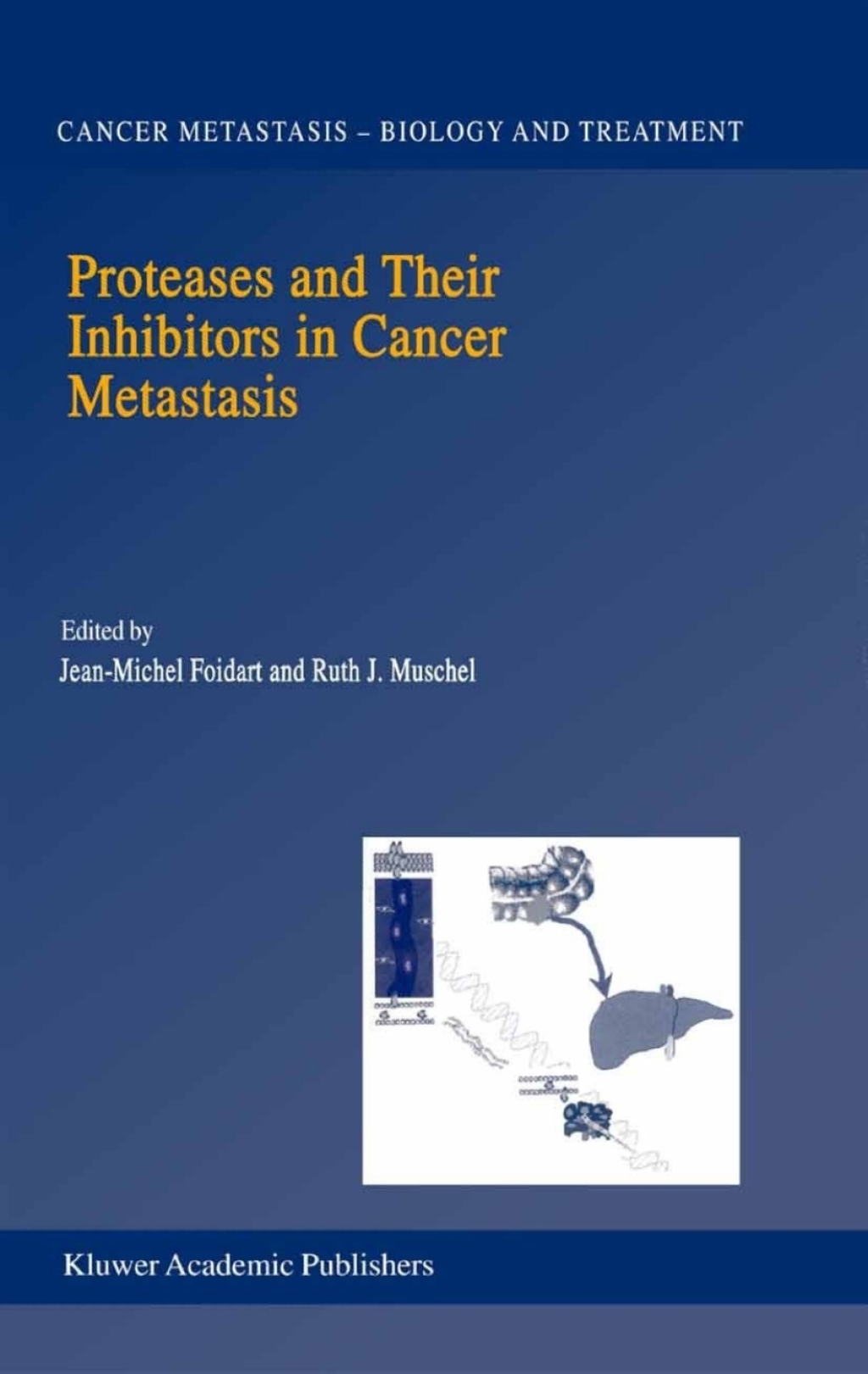 Proteases and Their Inhibitors in Cancer Metastasis  â€“ PDF/EPUB Version Downloadable