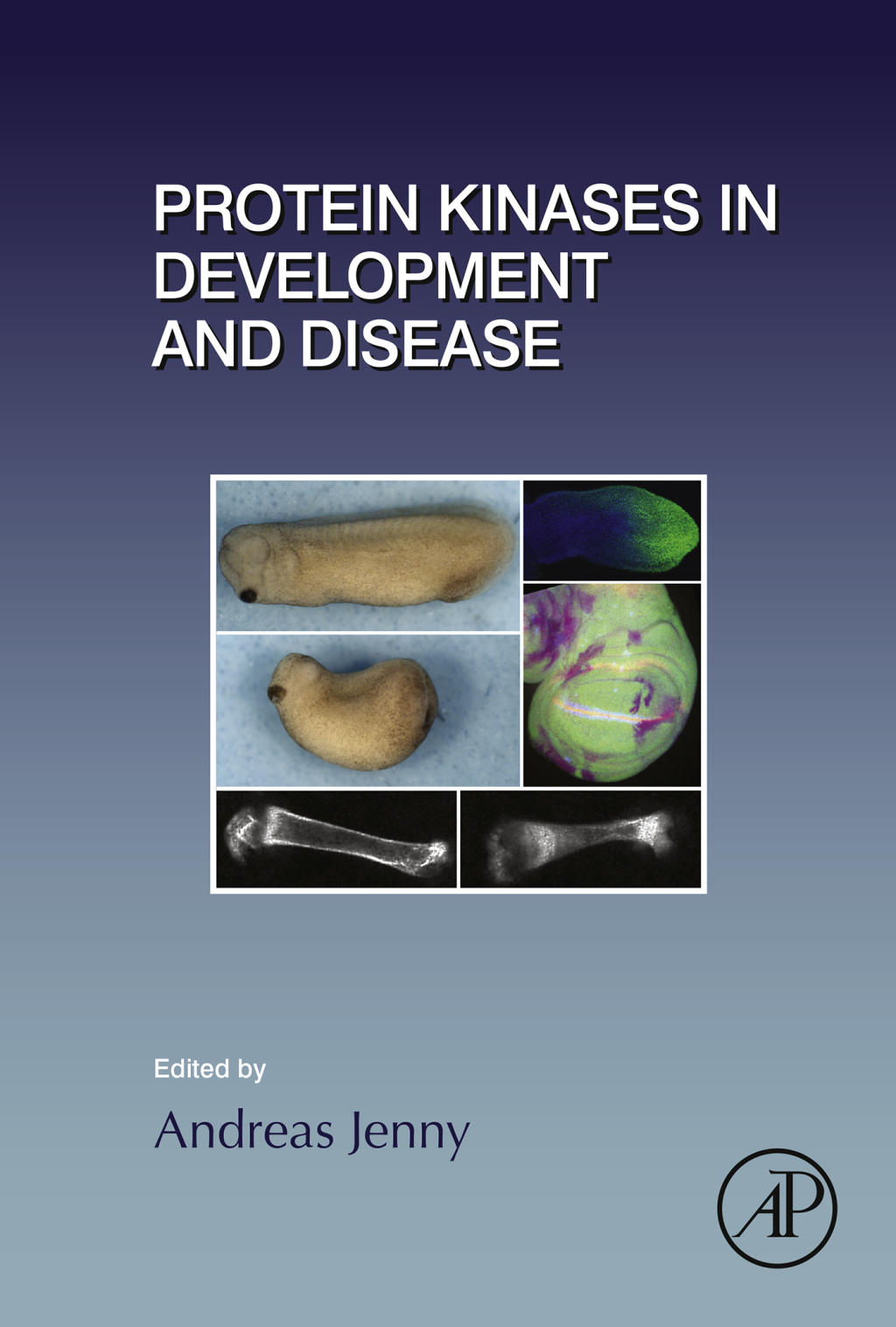 Protein Kinases in Development and Disease  â€“ PDF/EPUB Version Downloadable