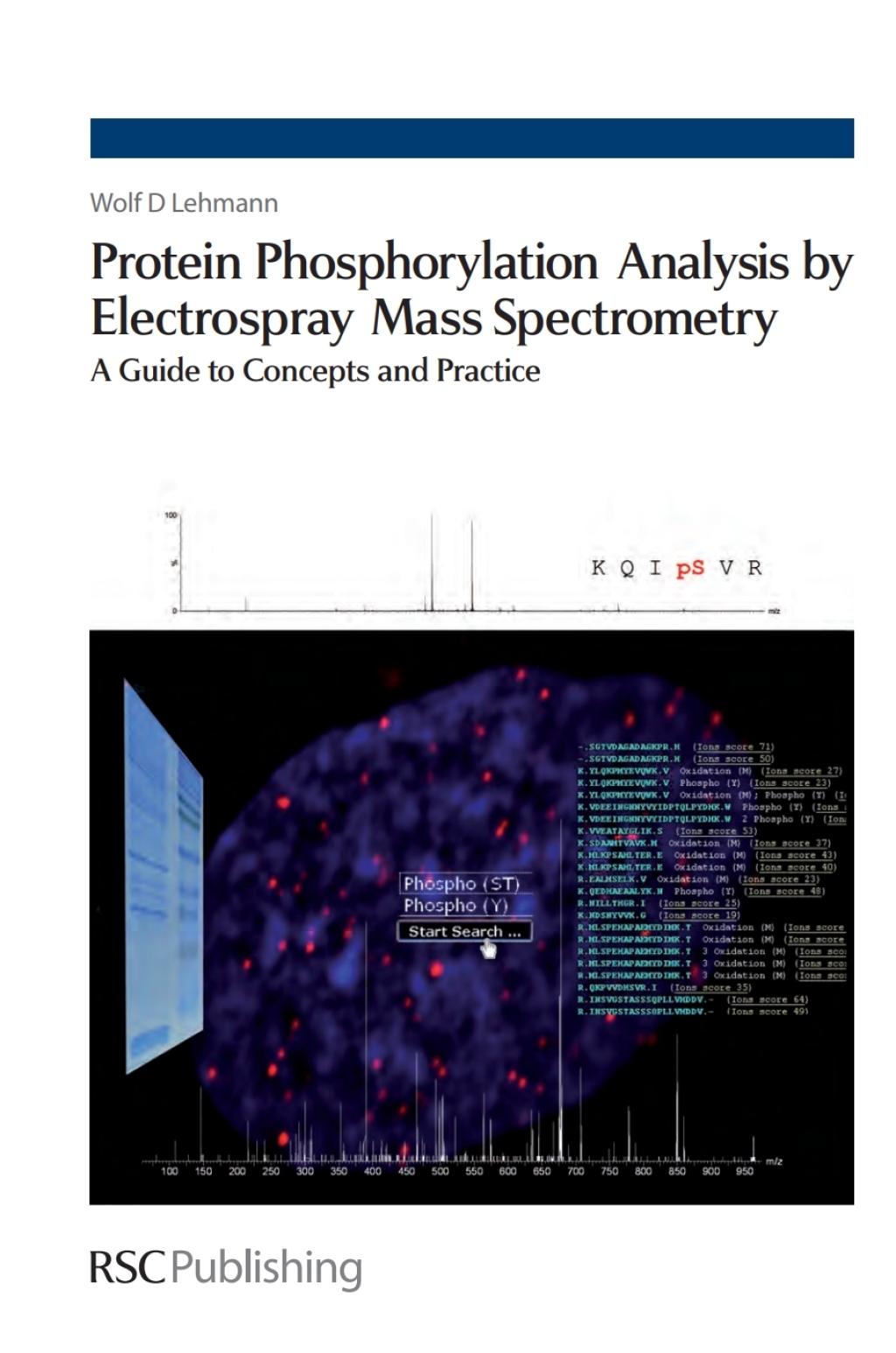 Protein Phosphorylation Analysis by Electrospray Mass Spectrometry A guide to concepts and practice 1st Edition â€“ PDF/EPUB Version Downloadable