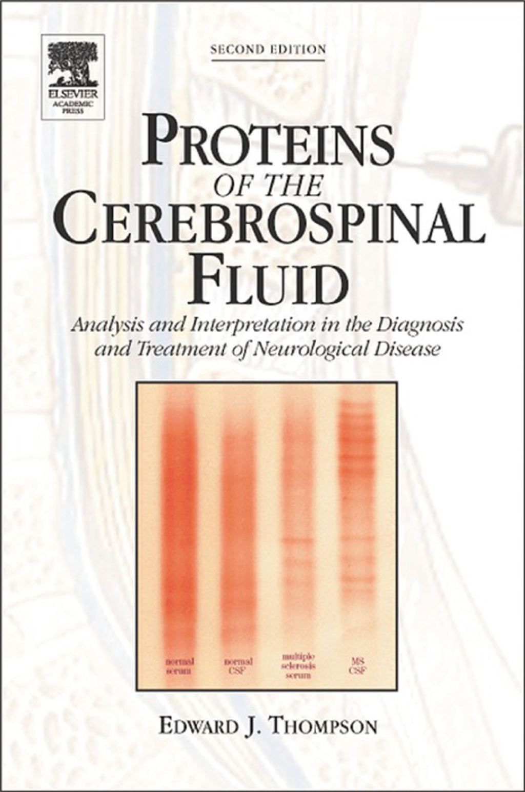 Proteins of the Cerebrospinal Fluid: Analysis & Interpretation in the Diagnosis and Treatment of Neurological Disease  â€“ PDF/EPUB Version Downloadable