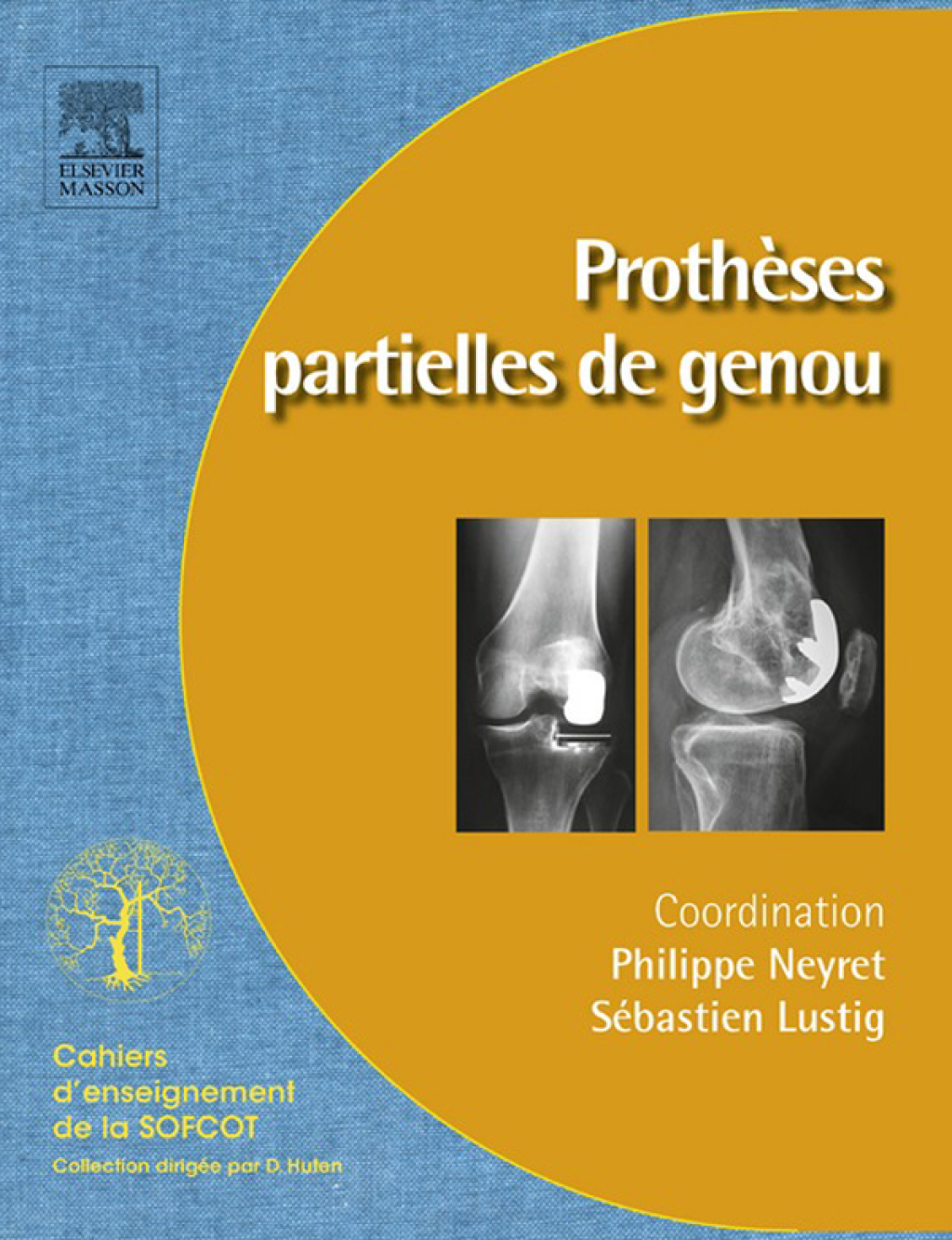 ProthÃ¨ses partielles du genou ProthÃ¨ses unicompartimentaires et fÃ©moropatellaires  â€“ PDF/EPUB Version Downloadable