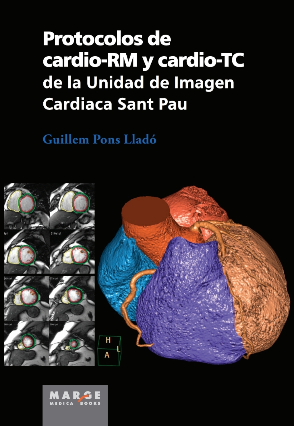 Protocolos de cardio-RM y cardio-TC de la Unidad de Imagen Cardiaca Sant Pau 1st Edition - (PDF/EPUB Version)