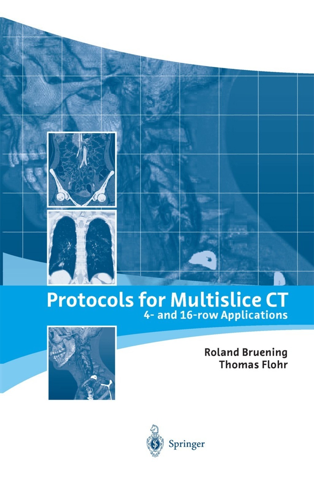Protocols for Multislice CT 4- and 16-row Applications 1st Edition â€“ PDF/EPUB Version Downloadable