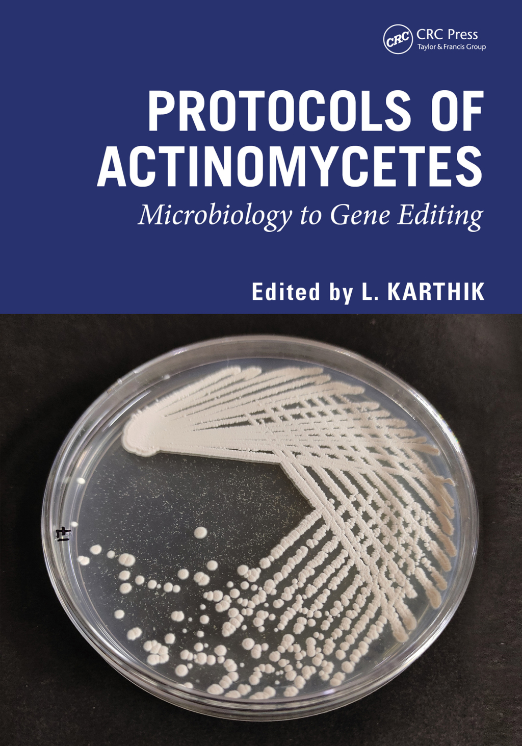 Protocols of Actinomycetes Microbiology to Gene editing 1st Edition â€“ PDF/EPUB Version Downloadable