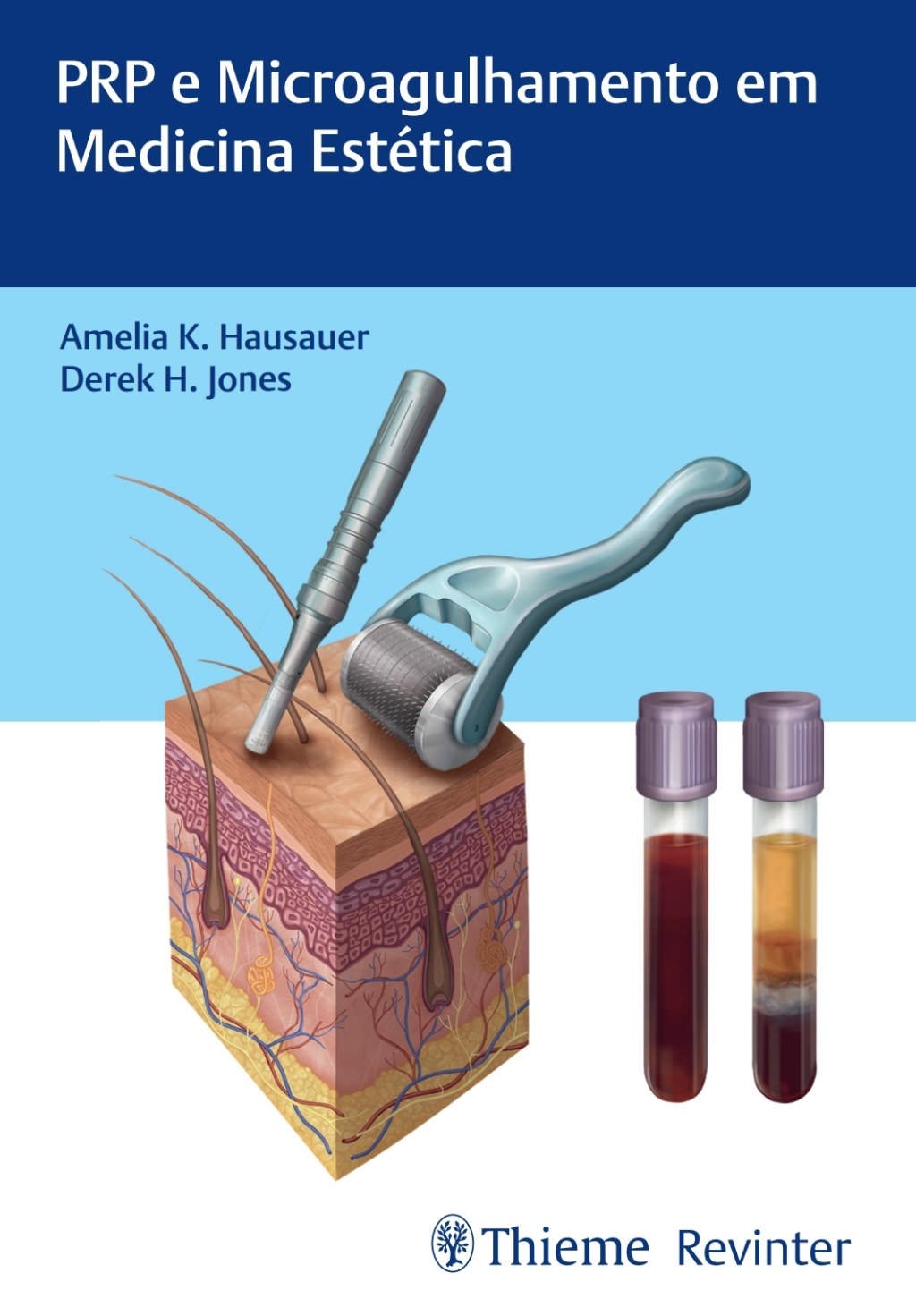 PRP e Microagulhamento em Medicina EstÃ©tica 1st Edition â€“ PDF/EPUB Version Downloadable