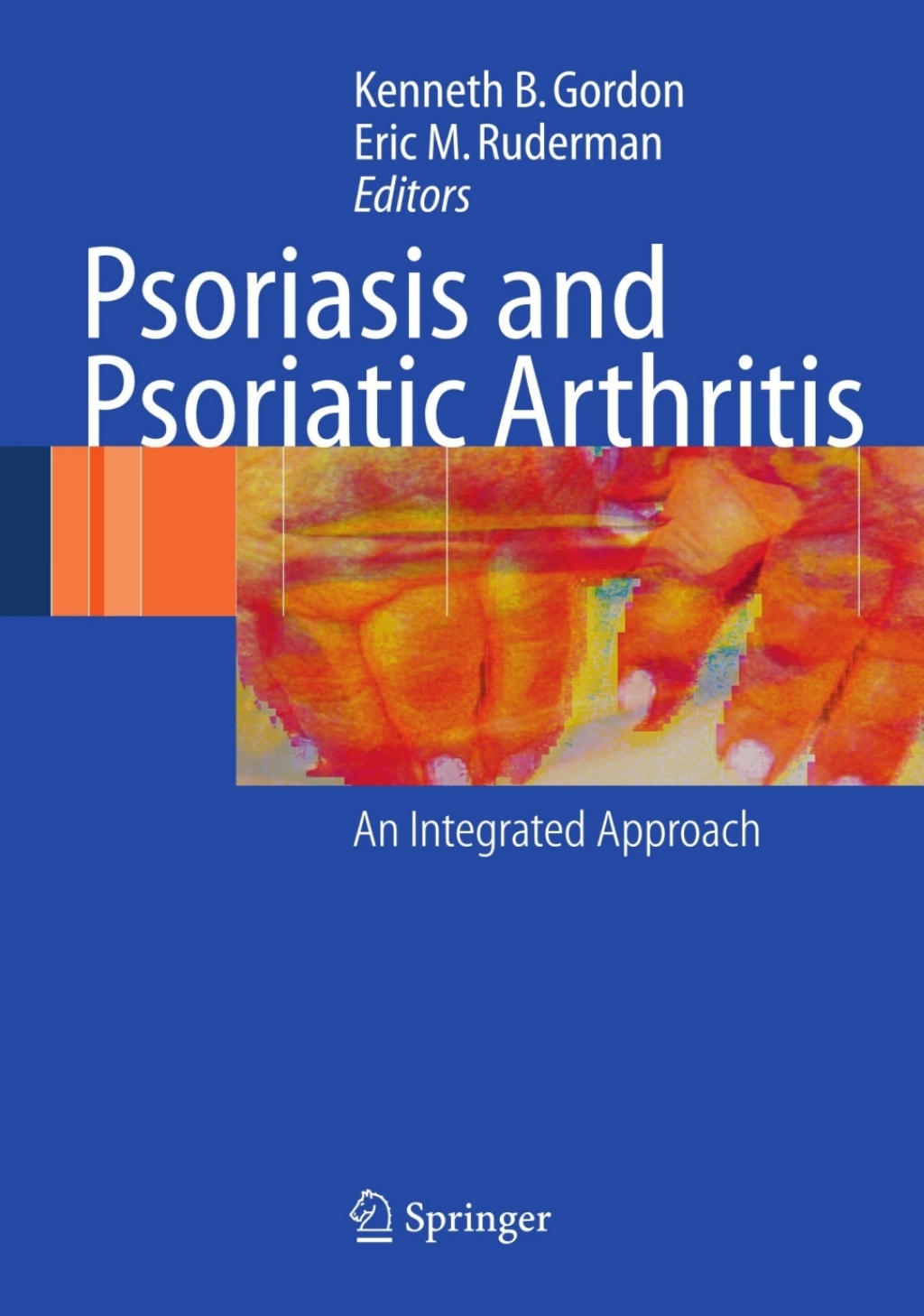 Psoriasis and Psoriatic Arthritis An Integrated Approach 1st Edition â€“ PDF/EPUB Version Downloadable