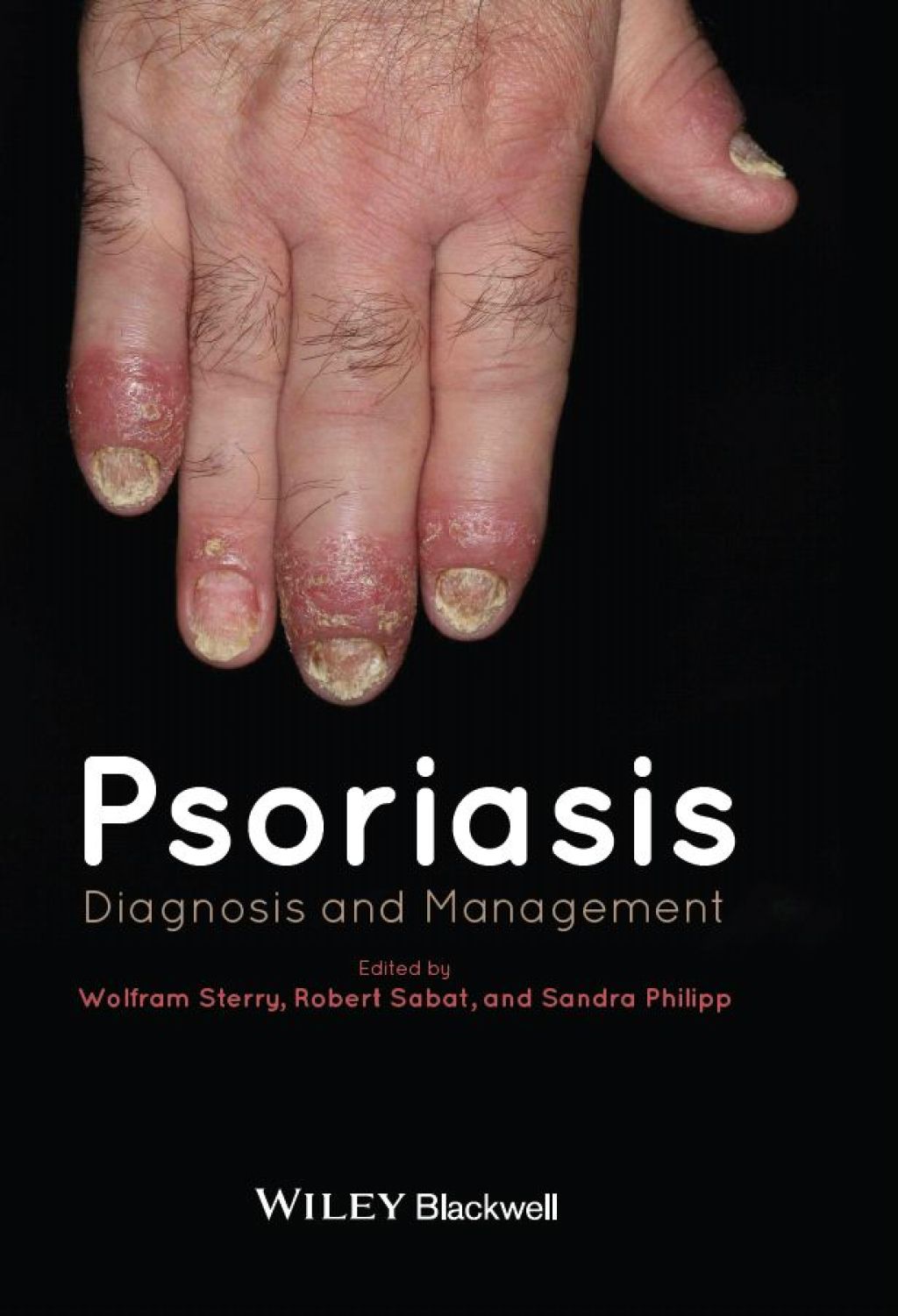 Psoriasis Diagnosis and Management 1st Edition â€“ PDF/EPUB Version Downloadable