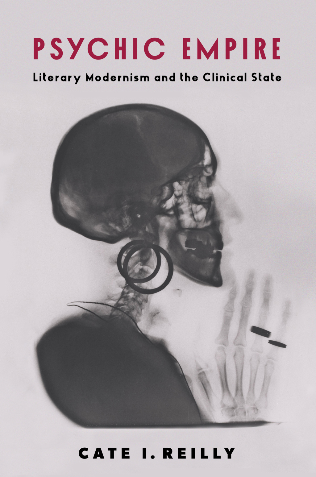 Psychic Empire Literary Modernism and the Clinical State - (PDF/EPUB Version)