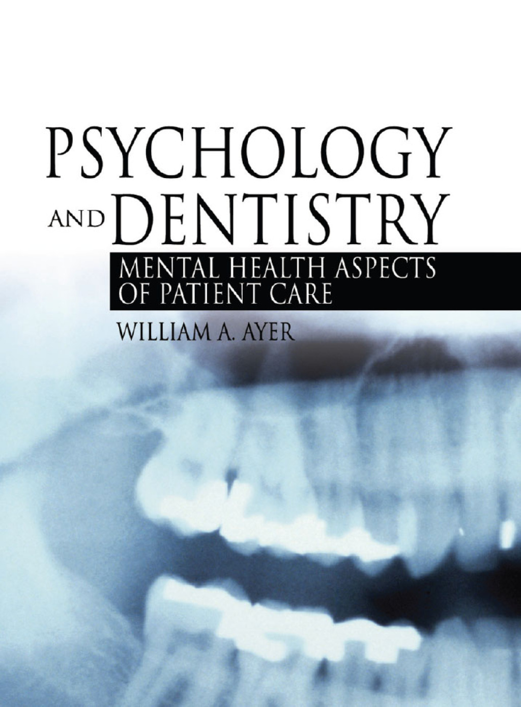 Psychology and Dentistry Mental Health Aspects of Patient Care 1st Edition â€“ PDF/EPUB Version Downloadable